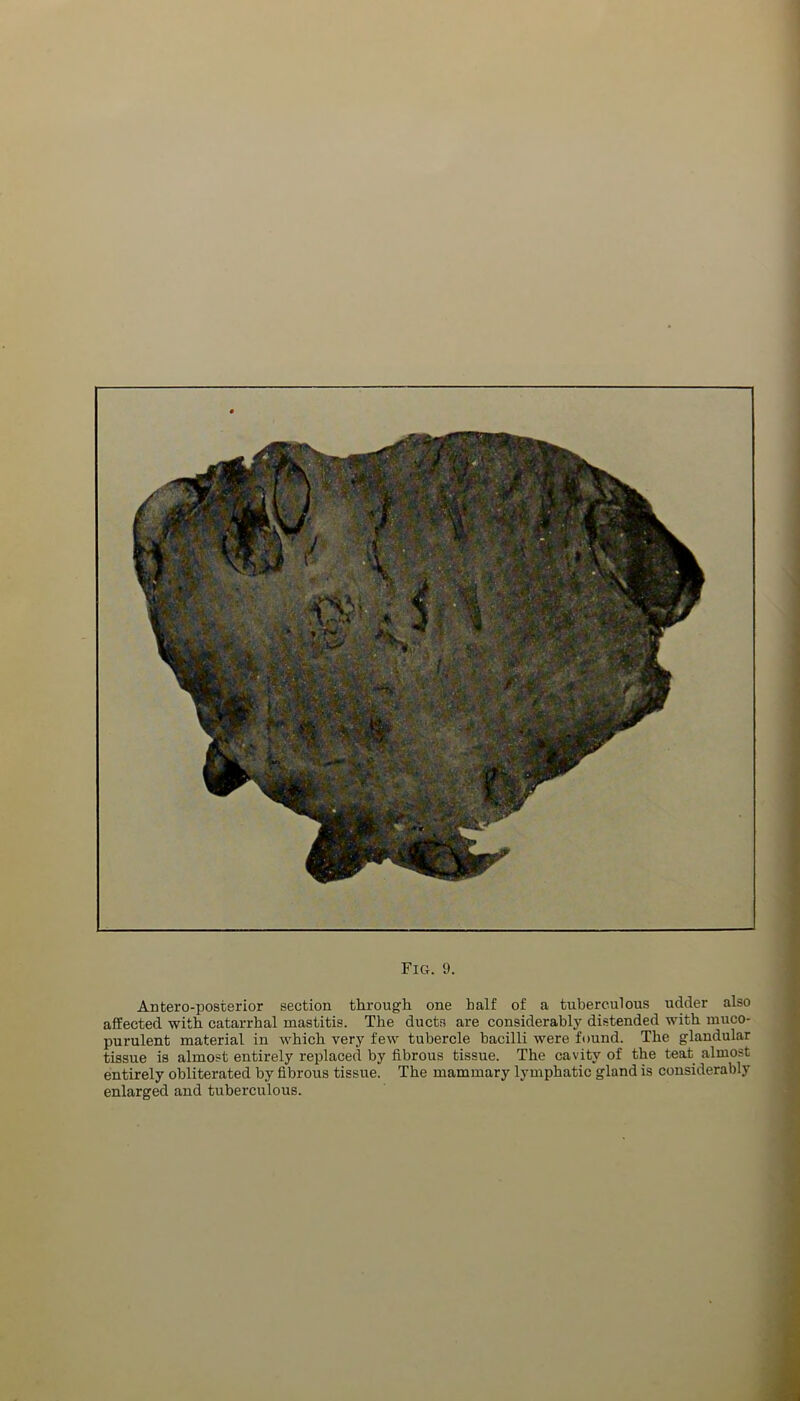 Antero-posterior section through one half of a tuberculous udder also affected with catarrhal mastitis. The ducts are considerably distended with muco- purulent material in which very few tubercle bacilli were found. The glandular tissue is almost entirely replaced by fibrous tissue. The cavity of the teat almost entirely obliterated by fibrous tissue. The mammary lymphatic gland is considerably enlarged and tuberculous.