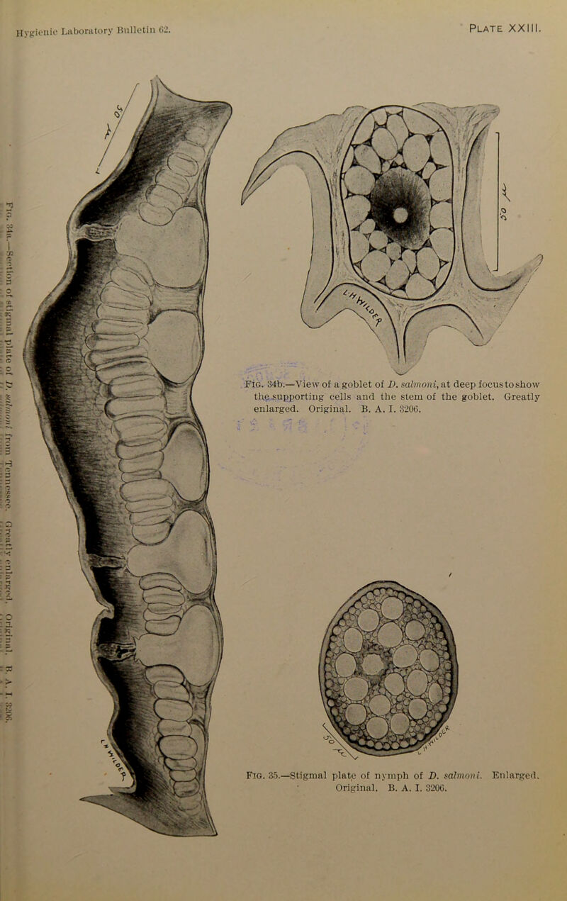 Fro. 34r.—Section of stigraal plate of 1). salmoni from Tennessee. Greatly enlarged. Original. H. A. I. 3200. Plate XXIII. Fig. 34b.—View of a goblet of D. salmoni, at deep focus to show th.e.supporting cells and the stem of the goblet. Greatly enlarged. Original. B. A. I. 3206. / Fig. 35.—Stigmal plate of nymph of D. salmoni. Enlarged. Original. B. A. I. 3206.