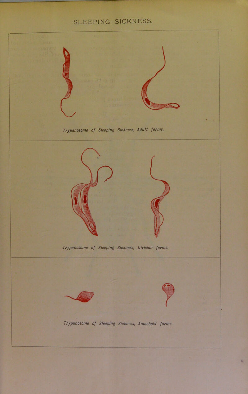 Trypanosome of Sleeping Sickness, Adult forms. Trypanosome of Sleeping Sickness, Division forms. Trypanosome of Sleeping Sickness, Amoeboid forms. I I 1