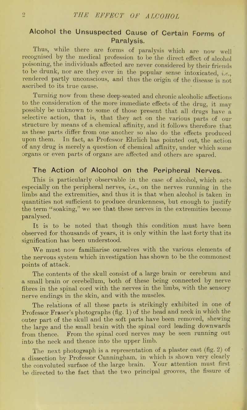 Alcohol the Unsuspected Cause of Certain Forms of Paralysis. Thus, while there are forms of paralysis which are now well recognised by the medical profession to be the direct effect of alcohol poisoning, the individuals affected are never considered by their friends to be drunk, nor are they ever in the popular sense intoxicated, i.n., rendered partly unconscious, and thus the origin of the disease is not ascribed to its true cause. Turning now from these deep-seated and chronic alcoholic affections to the consideration of the more immediate effects of the drug, it may possibly be unknown to some of those present that all drugs have a selective action, that is, that they act on the various parts of our structure by means of a chemical affinity, and it follows therefore that as these parts differ from one another so also do the effects produced upon them. In fact, as Professor Ehrlich has pointed out, the action of any drug is merely a question of chemical affinity, under which some organs or even parts of organs are affected and others are spared. The Action of Alcohol on the Peripheral Nerves. This is particularly observable in the case of alcohol, which acts especially on the peripheral nerves, i.e., on the nerves running in the limbs and the extremities, and thus it is that when alcohol is taken in quantities not sufficient to produce drunkenness, but enough to justify the term “soaking,” we see that these nerves in the extremities become paralysed. It is to be noted that though this condition must have been observed for thousands of years, it is only within the last forty that its signification has been understood. We must now familiarise ourselves with the various elements of the nervous system which investigation has shown to be the commonest points of attack. The contents of the skull consist of a large brain or cerebrum and a small brain or cerebellum, both of these being connected by nerve fibres in the spinal cord with the nerves in the limbs, with the sensory nerve endings in the skin, and with the muscles. The relations of all these parts is strikingly exhibited in one of Professor Fraser’s photographs (fig. 1) of the head and neck in which the outer part of the skull and the soft parts have been removed, shewing the large and the small brain with the spinal cord leading downwards from thence. From the spinal cord nerves may be seen running out into the neck and thence into the upper limb. The next photograph is a representation of a plaster cast (fig. 2) of a dissection by Professor Cunningham, in which is shown very clearly the convoluted surface of the large brain. \ our attention must first be directed to the fact that the two principal grooves, the fissure of