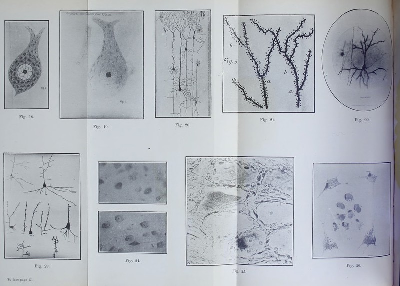 Fig. IS. Fig. 23. Fig. 21. /■\ ‘ : ■ u'S . V ■ . * . O , s ' Vwis^. Fig. 24. Fig. 25. Fig. 26. Fig. 19. : ON C anguon Cells? ■ - ■ A »• * >*** - .. » 2 •x '7'8efc ; * £ *• *• * } & t ' •*- v \v i y \. Jf jj. . : f % m i Fig. 20