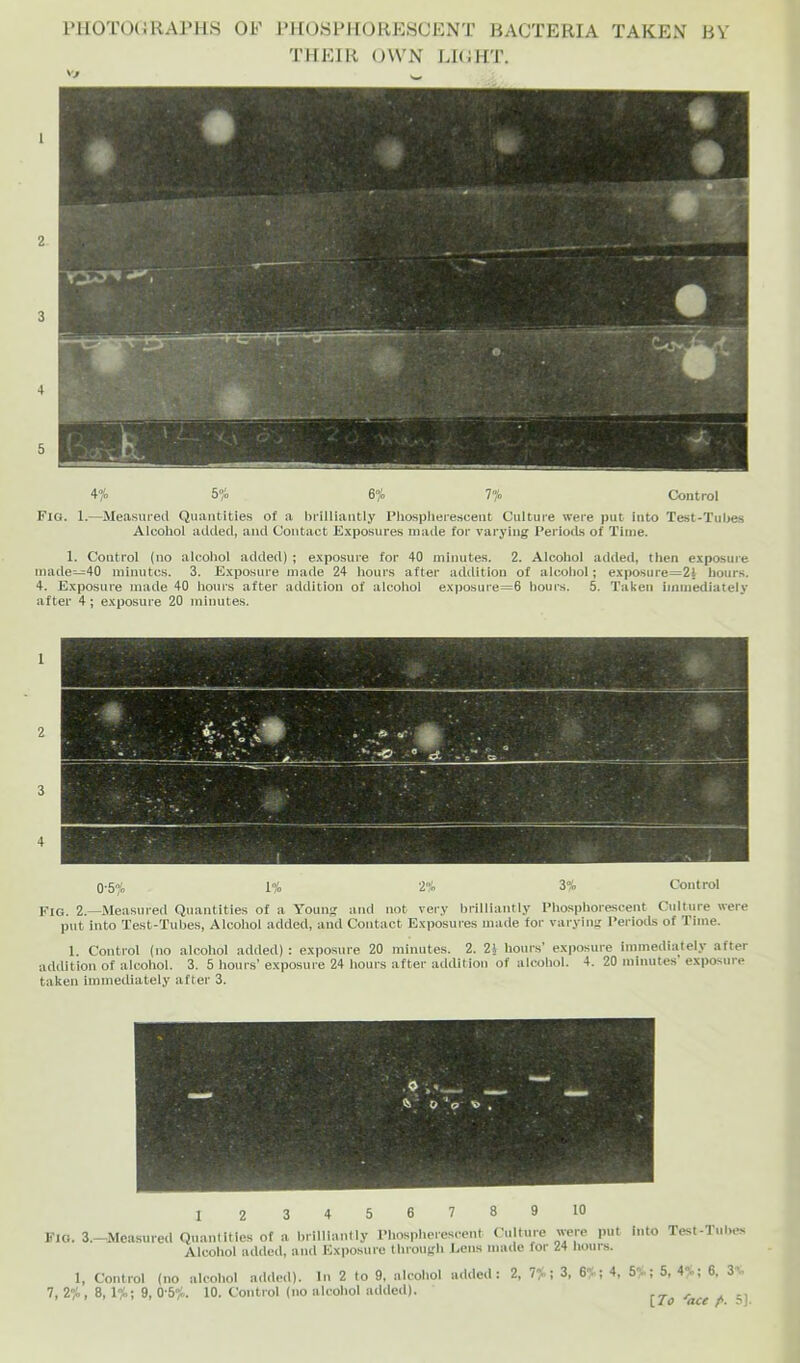 PIIOTOCRAJMIS OR IMIOSI’irORIvSCENT BACTERIA TAKEN BV THEIR OWN LHiHT. 470 5% 6% 7% Control Fia. 1.—Measured Quantities of a brilliantly Pliosplierescent Culture were put into Test-Tubes Alcohol added, and Contact Exposures made for varying Periods of Time. 1. Control (no alcohol added) ; exposure for 40 minutes. 2. Alcohol added, then exposure made—40 minutes. 3. Exposure made 24 hours after addition of alcohol; exposure=2l hours. 4. Exposure made 40 hours after addition of alcohol exposure=6 hours. 5. Taken immediately after 4; exposure 20 minutes. 0-5% 1% 2% 3% Control Kig. 2.—^Measured Quantities of a Young and not very brilliantly Phosphorescent Culture were put into Test-Tubes, Alcohol added, and Contact Exposures made for varying Periods of Time. 1. Control (no alcohol added) : exposure 20 minutes. 2. 2J hours’ exposure immediately after addition of alcohol. 3. 5 hours’exposure 24 hours after addition of alcohol. 4. 20 minutes exposure taken immediately after 3. I 2 3 4 5 6 7 8 9 10 Kio. 3.—Measured Qiiiinllties ot a hilllianlly I'hosphereseent Culture were put Into Test-Tiihes Alcohol added, and Kxposurc Ihroiitrli J>eus made for 24 hours. 1, Coutrol (no alcohol added). In 2 to 9, alcohol added: 2, Tr\ 3, 6. ; 4, 5..; 5, 4 ; 6, 3’