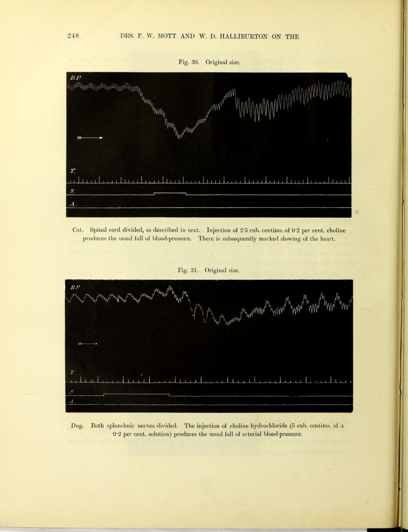 Fig. 30. Original size. Cat. Spinal cord divided, as described in text. Injection of 25 cub. centims. of 0'2 per cent, choline produces the usual fall of blood-pressure. There is subsequently marked slowing of the heart. Dog. Both splanchnic nerves divided. The injection of choline hydrochloride (5 cub. centims. of a 0-2 per cent, solution) produces the usual fall of arterial blood-pressure.