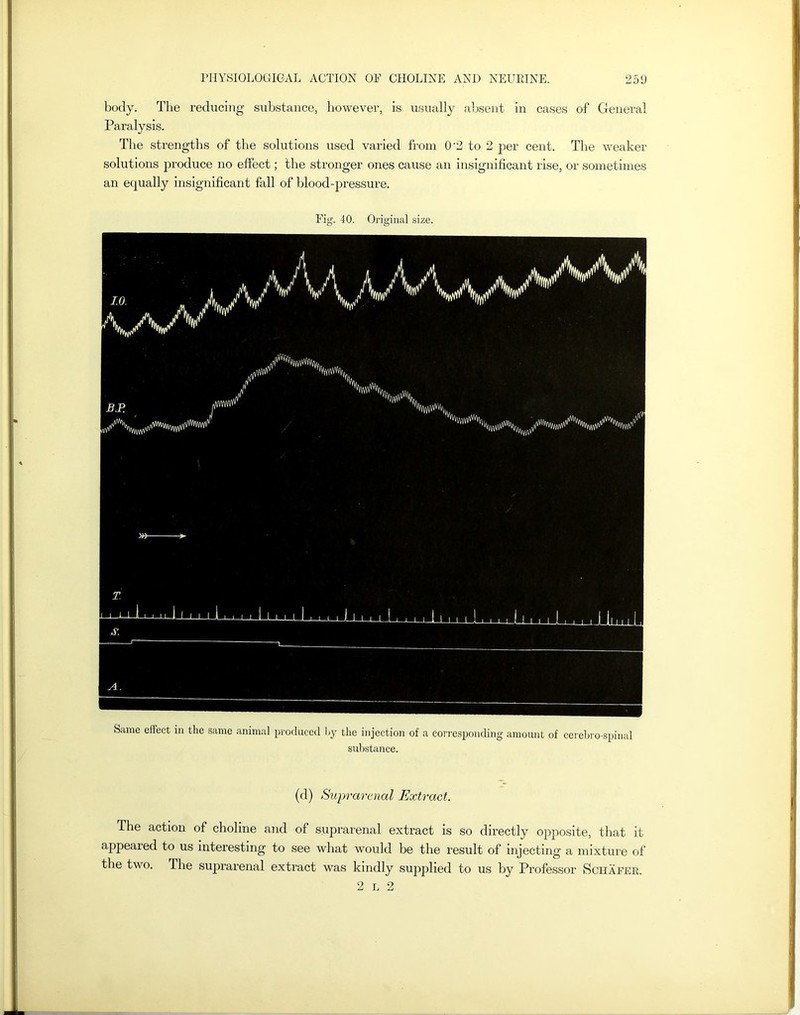 body. The reducing substance, however, is usually absent in cases of General Paralysis. The strengths of the solutions used varied from 0'2 to 2 per cent. The weaker solutions produce no effect; the stronger ones cause an insignificant rise, or sometimes an equally insignificant fall of blood-pressure. Fig. 40. Original size. Same effect in the same animal produced by the injection of a corresponding amount of cerebro-spinal substance. (d) Suprarenal Extract. The action of choline and of suprarenal extract is so directly opposite, that it appealed to us interesting to see what would be the result of injecting a mixture of the two. The suprarenal extract was kindly supplied to us by Professor Schafer. 2 l 2