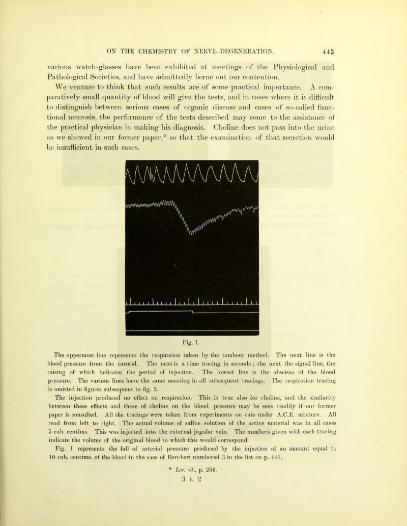 various watch-glasses have been exhibited at meetings of the Physiological and Pathological Societies, and have admittedly borne out our contention. We venture to think that such results are of some practical imjmrtance. A com- paratively small quantity of blood will give the tests, and in cases Avhere it is difficult to distinguish between serious cases of organic disease and cases of so-called func- tional neurosis, the performance of the tests described may come to the assistance of the practical physician in making his diagnosis. Choline does not pass into the urine as we showed in our former paper,* so that the examination of that secretion would be insufficient in such cases. Fig. 1. The uppermost line represents the respiration taken by the tambour method. The next line is the blood pressure from the carotid. The next is a time tracing in seconds; the next the signal line, the raising of which indicates the period of injection. The lowest line is the abscissa of the blood pressure. The various lines have the same meaning in all subsequent tracings. The respiration tracing is omitted in figures subsequent to fig. 2. The injection produced no effect on respiration. This is true also for choline, and the similarity between these effects and those of choline on the blood pressru’e may be seen readily if our former paper is consulted. All the tracings were taken from experiments on cats under A.C.E. mixture. All read from left to right. The actual volume of saline solution of the active material was in all cases 5 cub. centims. This was injected into the external jugular vein. The numbers given with each tracing indicate the volume of the original blood to which this would correspond. Fig. 1 represents the fall of arterial ijressure produced by the injection of an amount equal to 10 cub. centims. of the blood in the case of Beri-beri numbered 3 in the list on p. 441. * Loc. rif., p. 256. 3 L 2