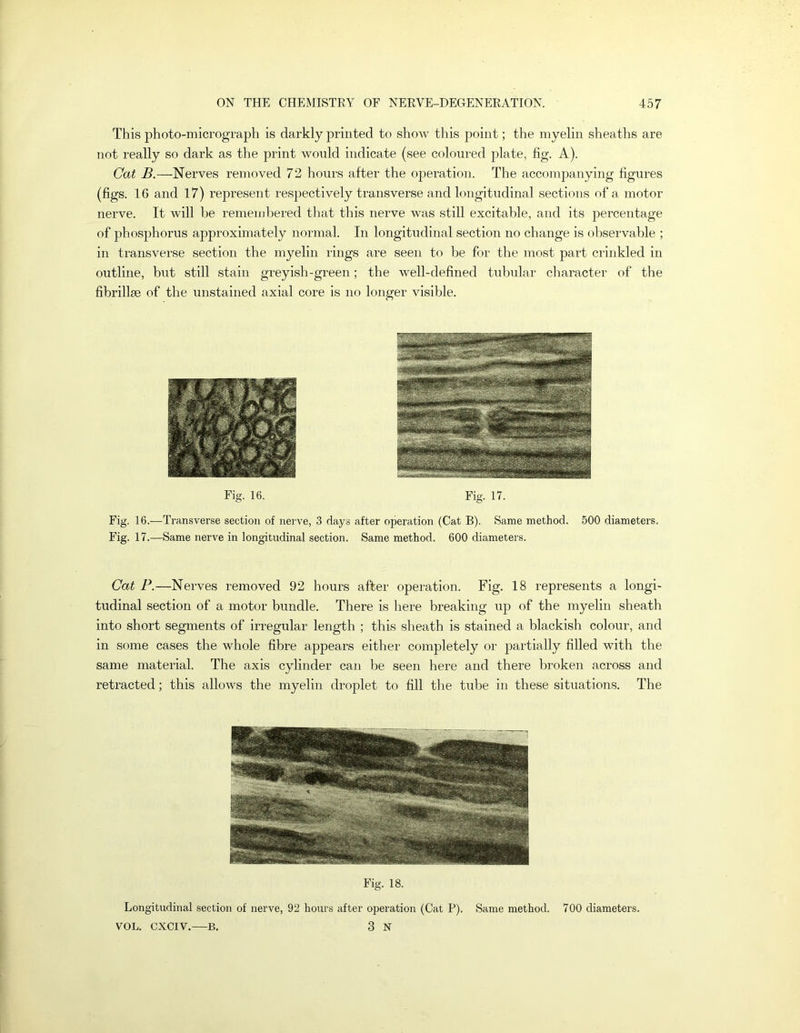 This jDhoto-micrograph is darkly printed to show this point; the myelin sheaths are not really so dark as the print wonld indicate (see coloured plate, fig. A). Cat B.—Nerves removed 72 hours after the operation. The accompanying figures (figs. 16 and 17) represent respectively transverse and longitudinal sections of a motor nerve. It will be remembered that this nerve was stiU excitable, and its percentage of phosphorus approximately normal. In longitudinal section no change is observable ; in transverse section the myelin rings are seen to be for the most part crinkled in outline, but still stain greyish-green; the well-defined tubular character of the fibrillae of the unstained axial core is no longer visible. Fig. 16. Fig. 17. Fig. 16.—Transverse section of nerve, 3 days after operation (Cat B). Same method. 500 diameters. Fig. 17.—Same nerve in longitudinal section. Same method. 600 diameters. Cat P.—Nerves removed 92 hours after operation. Fig. 18 represents a longi- tudinal section of a motor bundle. There is here breaking up of the myelin sheath into short segments of irregular length ; this sheath is stained a blackish colour, and in some cases the whole fibre appears either completely or partially filled with the same material. The axis cylinder can be seen here and there broken across and retracted; this allows the myelin droplet to fill the tube in these situations. The Fig. 18. Longitudinal section of nerve, 92 hours after operation (Cat P). Same method. 700 diameters. VOL. CXCIV.—B. 3 N