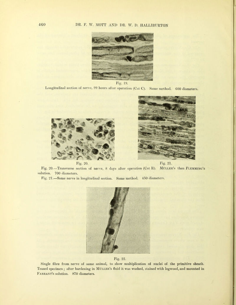 Fig. 20. Fig. 21. Fig. 20.—Transverse section of nerve, 8 days after operation (Cat R). Muller’s then Flemming’s solution. 700 diameters. Fig. 21.—Same nerve in longitudinal section. Same method. 450 diameters. Fig. 22. Single fibre from nerve of same animal, to show multiplication of nuclei of the primitive sheath. Teased specimen; after hardening in Muller’s fluid it was washed, stained with logwood, and mounted in Farrant’s solution. 870 diameters. Fig. 19. Longitudinal section of nerve, 99 hours after operation (Cat C). Same method. 600 diameters.