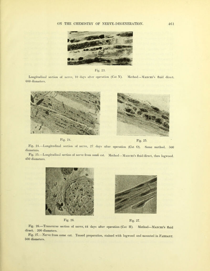 Fig. 23. Longitudinal section of nerve, 10 days after operation (Cat N). Method—Marchi’s fluid direct. 600 diameters. Fig. 24. Fig, 25. lig. 24. Longitudinal section of nerve, 2/ days after oioeration (Cat 0). Same method. 500 diameters. Fig. 25.—Longitudinal section of nerve from samh cat. Method—Marchi’s fluid direct, then logwood. 450 diameters. Fig. 26. Fig. 27. Fig. 26. Transverse section of nerve, 44 days after operation (Cat H). Method—Marchi’s fluid direct. 200 diameters. Fig. 27. Nerve from same cat. Teased preparation, stained with logwood and mounted in Farrant. 500 diameters.