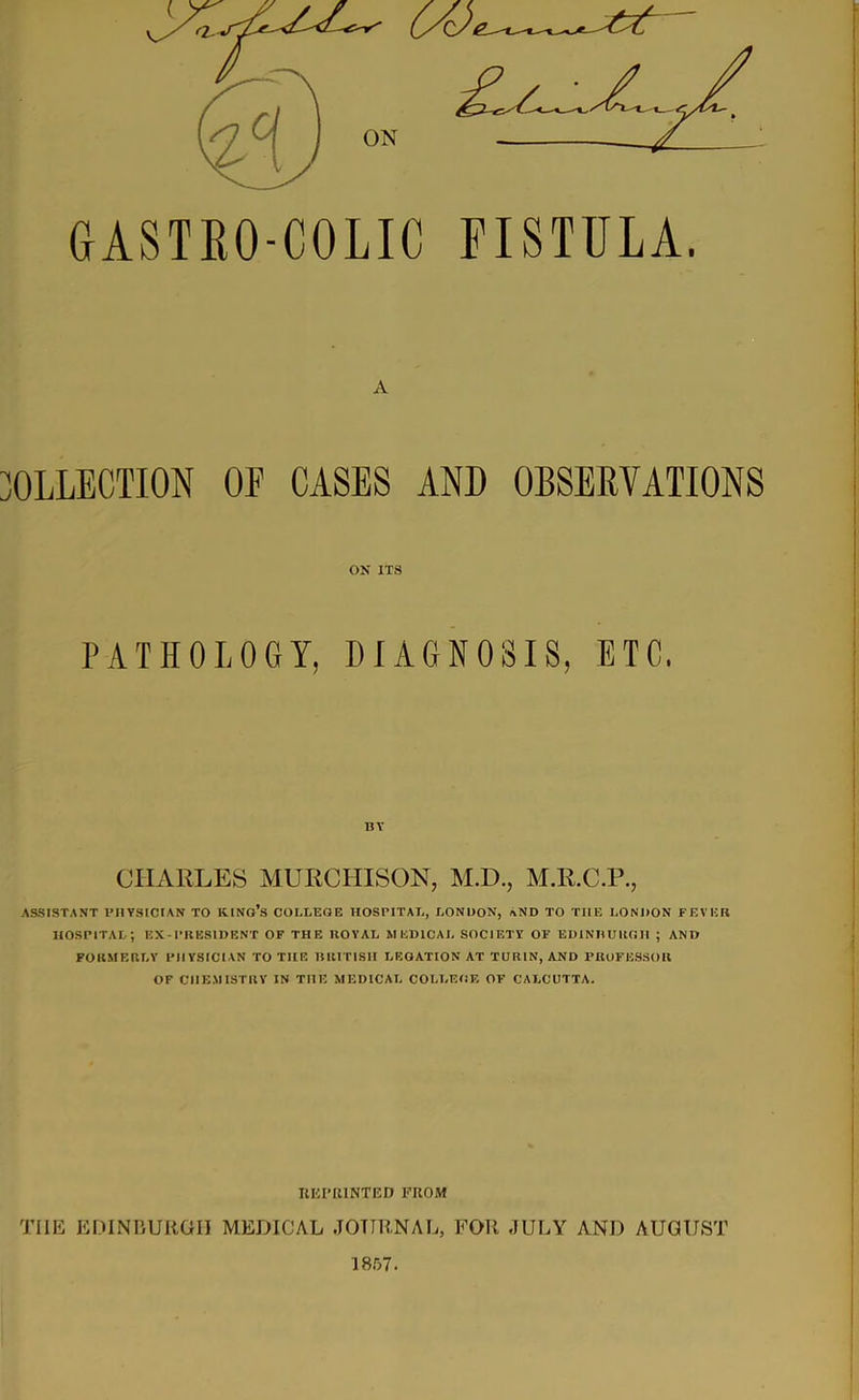 r •> GASTKO-COLIC FISTULA. A OLLECTION OF CASES AND OBSERVATIONS ON ITS PATHOLOGY, DIAGNOSIS, ETC, CHARLES MURCHISON, M.D., M.R.C.P., ASSISTANT PHYSICIAN TO KING’S COLLEGE HOSPITAL, LONDON, AND TO THE LONDON FEVER hospital; ex - president of the royal medical society of edinruugh ; and FORMERLY PHYSICIAN TO THE BRITISH LEGATION AT TURIN, AND PROFESSOR OF CHEMISTRY IN THE MEDICAL COLLEGE OF CALCUTTA. REPRINTED FROM THE EDINBURGH MEDICAL JOURNAL, FOR JULY AND AUGUST 1857.