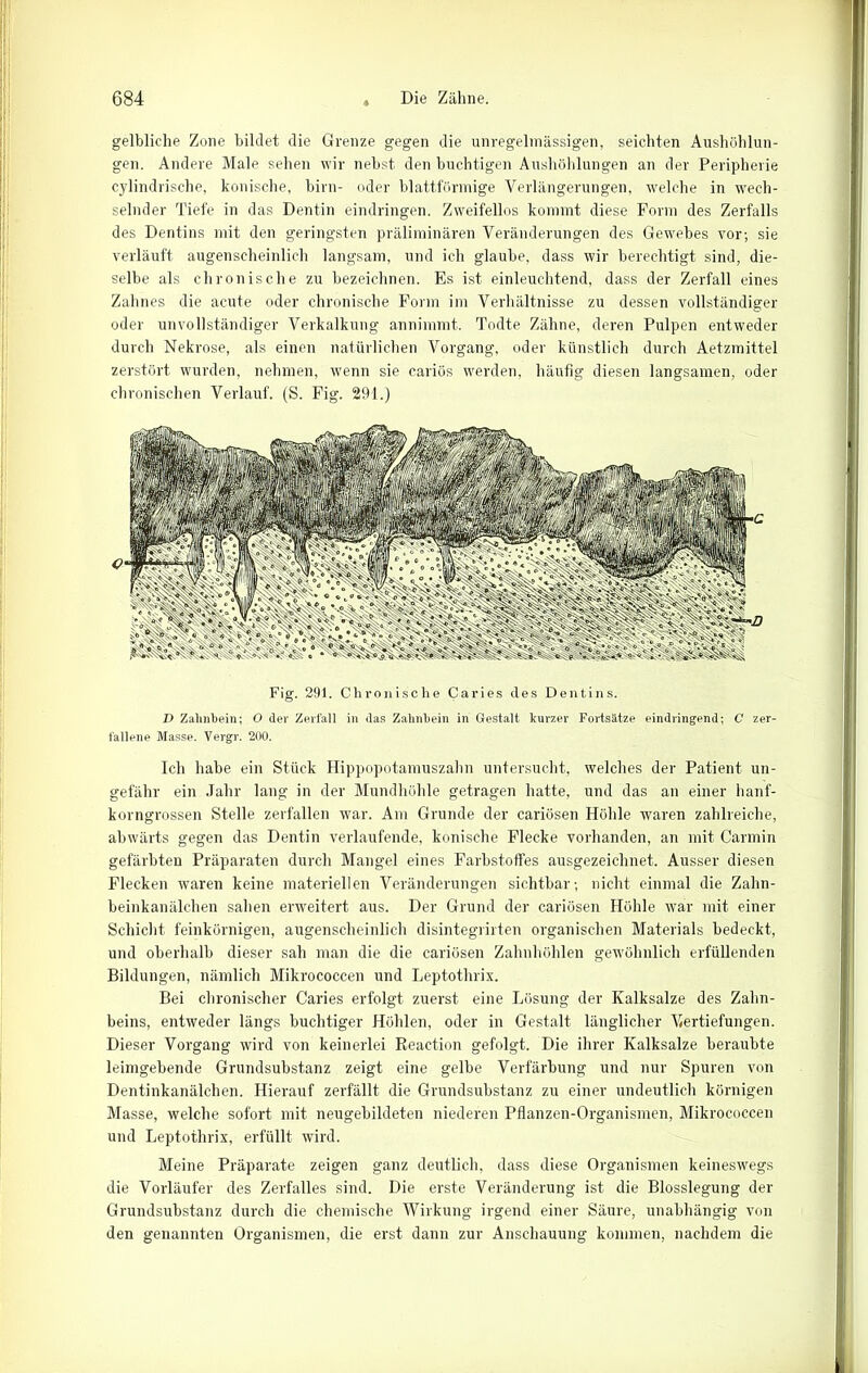 gelbliche Zone bildet die Grenze gegen die unregelmässigen, seichten Aushöhlun- gen. Andere Male sehen wir nebst den buchtigen Aushöhlungen an der Peripherie cylindrische, konische, birn- oder blattförmige Verlängerungen, welche in wech- selnder Tiefe in das Dentin eindringen. Zweifellos kommt diese Form des Zerfalls des Dentins mit den geringsten präliminären Veränderungen des Gewebes vor; sie verläuft augenscheinlich langsam, und ich glaube, dass wir berechtigt sind, die- selbe als chronische zu bezeichnen. Es ist einleuchtend, dass der Zerfall eines Zahnes die acute oder chronische Form im Verhältnisse zu dessen vollständiger oder unvollständiger Verkalkung annimmt. Todte Zähne, deren Pulpen entweder durch Nekrose, als einen natürlichen Vorgang, oder künstlich durch Aetzmittel zerstört wurden, nehmen, wenn sie cariös werden, häufig diesen langsamen, oder chronischen Verlauf. (S. Fig. 291.) Fig. 291. C hronische Caries des Dentins. I> Zahnbein; O der Zerfall in das Zahnbein in Gestalt kurzer Fortsätze eindringend; C zer- fallene Masse. Vergr. 200. Ich habe ein Stück Hippopotamuszahn untersucht, welches der Patient un- gefähr ein Jahr lang in der Mundhöhle getragen hatte, und das an einer hanf- korngrossen Stelle zerfallen war. Am Grunde der cariösen Höhle waren zahlreiche, abwärts gegen das Dentin verlaufende, konische Flecke vorhanden, an mit Carmin gefärbten Präparaten durch Mangel eines Farbstoffes ausgezeichnet. Ausser diesen Flecken waren keine materiellen Veränderungen sichtbar-, nicht einmal die Zahn- beinkanälchen sahen erweitert aus. Der Grund der cariösen Hohle war mit einer Schicht feinkörnigen, augenscheinlich disintegrirten organischen Materials bedeckt, und oberhalb dieser sah man die die cariösen Zahnhöhlen gewöhnlich erfüllenden Bildungen, nämlich Mikrococcen und Leptothrix. Bei chronischer Caries erfolgt zuerst eine Lösung der Kalksalze des Zahn- beins, entweder längs buchtiger Höhlen, oder in Gestalt länglicher Vertiefungen. Dieser Vorgang wird von keinerlei Reaction gefolgt. Die ihrer Kalksalze beraubte leimgebende Grundsubstanz zeigt eine gelbe Verfärbung und nur Spuren von Dentinkanälchen. Hierauf zerfällt die Grundsubstanz zu einer undeutlich körnigen Masse, welche sofort mit neugebildeten niederen Pflanzen-Organismen, Mikrococcen und Leptothrix, erfüllt wird. Meine Präparate zeigen ganz deutlich, dass diese Organismen keineswegs die Vorläufer des Zerfalles sind. Die erste Veränderung ist die Blosslegung der Grundsubstanz durch die chemische Wirkung irgend einer Säure, unabhängig von den genannten Organismen, die erst dann zur Anschauung kommen, nachdem die