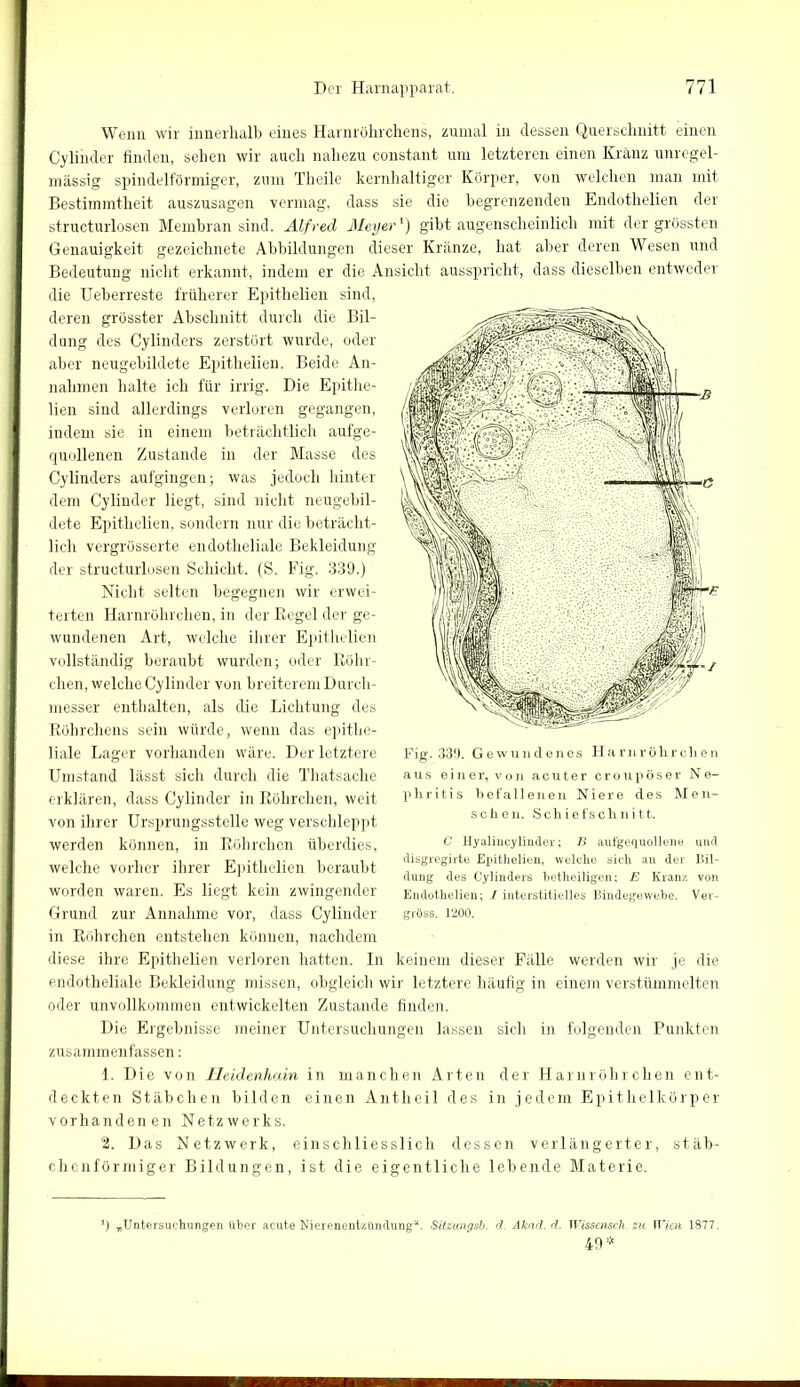 Wenn wir innerhalb eines Harnröhrchens, zumal in dessen Querschnitt einen Cylinder finden, sehen wir auch nahezu constant um letzteren einen Kränz unregel- mässig spindelförmiger, zum Theile kernhaltiger Körper, von welchen man mit Bestimmtheit auszusagen vermag, dass sie die begrenzenden Endotlielien der structurlosen Membran sind. Alfred Meyer') gibt augenscheinlich mit der grössten Genauigkeit gezeichnete Abbildungen dieser Kränze, hat aber deren Wesen und Bedeutung nicht erkannt, indem er die Ansicht ausspricht, dass dieselben entweder die Ueberreste früherer Epithelien sind, deren grösster Abschnitt durch die Bil- dung des Cylinders zerstört wurde, oder aber neugebildete Epithelien. Beide An- nahmen halte ich für irrig. Die Epithe- lien sind allerdings verloren gegangen, indem sie in einem beträchtlich aufge- quollenen Zustande in der Masse des Cylinders aufgingen; was jedoch hinter dem Cylinder liegt, sind nicht neugebil- dete Epithelien, sondern nur die beträcht- lich vergrösserte endotheliale Bekleidung der structurlosen Schicht. (S. Fig. 339.) Nicht selten begegnen wir erwei- terten Harnröhrchen, in der Regel der ge- wundenen Art, welche ihrer Epithelien vollständig beraubt wurden; oder Röhr- chen, welche Cylinder von breiterem Durch- messer enthalten, als die Lichtung des Röhrchens sein würde, wenn das epithe- liale Lager vorhanden wäre. Der letztere Umstand lässt sich durch die Thatsache erklären, dass Cylinder in Röhrchen, weit von ihrer Ursprungsstelle weg verschleppt werden können, in Röhrchen überdies, welche vorher ihrer Epithelien beraubt worden waren. Es liegt kein zwingender Grund zur Annahme vor, dass Cylinder in Röhrchen entstehen können, nachdem diese ihre Epithelien verloren hatten. In keinem dieser Fälle werden wir je die endotheliale Bekleidung missen, obgleich wir letztere häufig in einem verstümmelten oder unvollkommen entwickelten Zustande finden. Die Ergebnisse meiner Untersuchungen lassen sich in folgenden Punkten zusammenfassen: 1. Die von Heidenhain in manchen Arten der Harnröhrchen ent- deckten Stäbchen bilden einen Autheil des in jedem Epithelkörper vorhandenen Netzwerks. 2. Das Netzwerk, einschliesslich dessen verlängerter, stäb- chenförmiger Bildungen, ist die eigentliche lebende Materie. Fig. 339. Gewundenes Harnröhrchen aus einer, von acuter croupöser Ne- phritis befallenen Niere des Men- schen. Schief schnitt. C Hyalincylinder; B aufgequollene und disgregirte Epithelien, welche sich an der Bil- dung des Cylinders betlieiligen; E Kranz von Endotlielien; 1 interstitielles Bindegewebe. Ver- gröss. 1Z00. ‘) „Untersuchungen aber acute Nierenentzündung“. Sitgungsb. d. Akad.d. Wissenscli.zu Wien 1877. 49 *