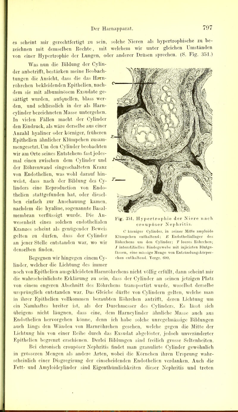 es scheint mir gerechtfertigt zu sein, solche Nieren als hypertrophische zu be- zeichnen mit demselben Rechte, mit welchem wir unter gleichen Umständen von einer Hypertrophie der Lungen, oder anderer Drüsen sprechen. (S. IUg. 351.) Was nun die Bildung der Cylin- der anbetrifft, bestärken meine Beobach- tungen die Ansicht, dass die das Hann- röhrchen bekleidenden Epithelien, nach- dem sie mit albuminösem Exsudate ge- sättigt wurden, aufquellen, blass wer- den, und schliesslich in der als Harn- cylinder bezeichneten Masse untergehen. In vielen Fällen macht der Cylinder den Eindruck, als wäre derselbe aus einer Anzahl hyaliner oder körniger, früheren Epithelien ähnlicher Klümpchen zusam- mengesetzt. Um den Cylinder beobachten wir am Orte seines Entstehens fast jedes- mal einen zwischen dem Cylinder und der Röhrenwand eingeschalteten Kranz von Endothelien, was wohl darauf hin- weist, dass nach der Bildung des Cy- linders eine Reproduction von Endo- thelien stattgefunden hat, oder diesel- ben einfach zur Anschauung kamen, nachdem die hyaline, sogenannte Basal- membran verflüssigt wurde. Die An- wesenheit eines solchen endothelialen Kranzes scheint als genügender Beweis gelten zu dürfen, dass der Cylinder an jener Stelle entstanden war, wo wir denselben finden. Begegnen wir hingegen einem Cy- linder, welcher die Lichtung des immer noch von Epithelien ausgekleideten Harnröhrchens nicht völlig erfüllt, dann scheint mir die wahrscheinlichste Erklärung zu sein, dass der Cylinder an seinen jetzigen Platz von einem engeren Abschnitt des Röhrchens transportirt wurde, woselbst derselbe ursprünglich entstanden war. Das Gleiche dürfte von Cylindern gelten, welche man in ihrer Epithelien vollkommen beraubten Röhrchen antrifft, deren Lichtung um ein Namhaftes breiter ist, als der Durchmesser des Cylinders. Es lässt sich übrigens nicht läugnen, dass eine, dem Harncylinder ähnliche Masse auch aus Endothelien hervorgehen könne, denn ich habe solche unregelmässige Bildungen auch längs den Wänden von Harnröhrchen gesehen, welche gegen die Mitte der Lichtung hin von einer Reihe durch das Exsudat abgelöster, jedoch unveränderter Epithelien begrenzt erschienen. Derlei Bildungen sind freilich grosse Seltenheiten. Bei chronisch croupöser Nephritis findet man granulirte Cylinder gewöhnlich in grösseren Mengen als andere Arten, wobei die Körnchen ihren Ursprung wahr- scheinlich einer Disgregirung der einscheidenden Endothelien verdanken. Auch die Fett- und Amyloideylinder sind Eigenthümlichkeiten dieser Nephritis und treten Fig. 351. Hypertrophie der Niere nach croupöser Nephritis. C körniger Cylinder, in seiner Mitte amyloide Klümpchen enthaltend; E Endotheliallager des Röhrchens um den Cylinder; T leeres Röhrchen; I interstitielles Bindegewebe mit injieirten Blutge- fässen, eine massige Menge von Entzündungskörper- chen enthaltend. Vergr. 600.