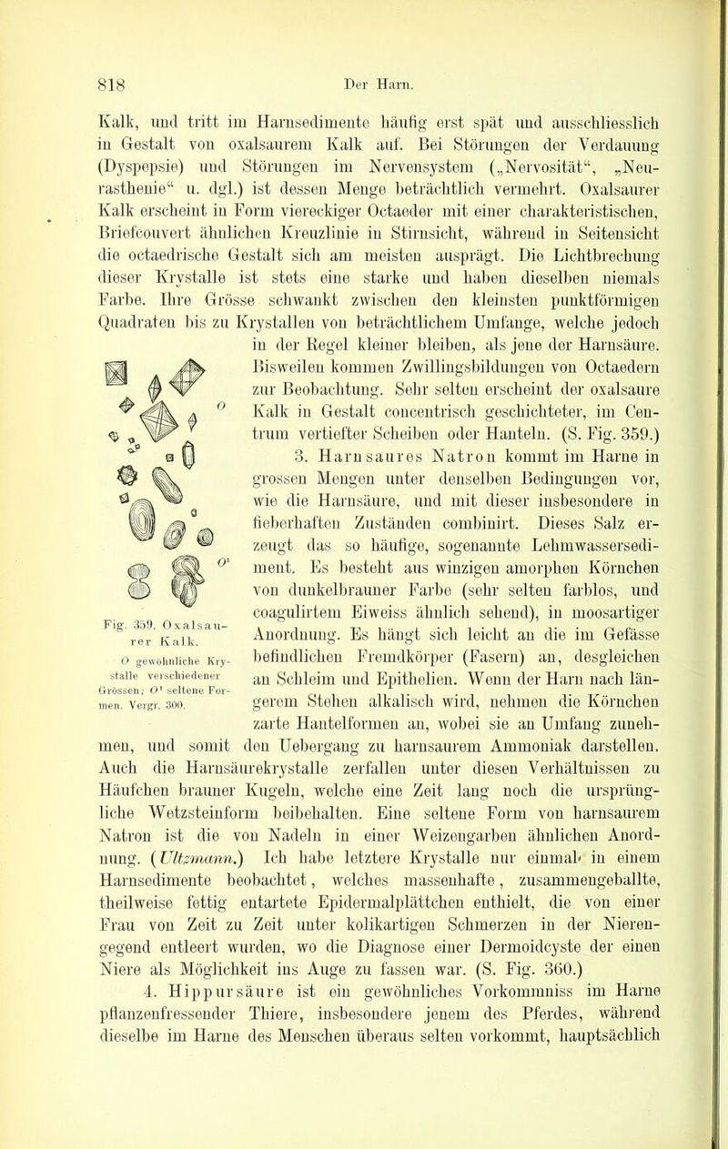 Kalk, und tritt im Harnsedimente häufig erst spät und ausschliesslich in Gestalt von oxalsaurem Kalk auf. Bei Störungen der Verdauung (Dyspepsie) und Störungen im Nervensystem („Nervosität“, „Neu- rasthenie“ u. dgl.) ist dessen Menge beträchtlich vermehrt. Oxalsaurer Kalk erscheint in Form viereckiger Octaeder mit einer charakteristischen, Briefcouvert ähnlichen Kreuzlinie in Stirnsicht, während in Seitensicht die octaedrische Gestalt sich am meisten ausprägt. Die Lichtbrechung dieser Krystalle ist stets eine starke und haben dieselben niemals Farbe. Ihre Grösse schwankt zwischen den kleinsten punktförmigen Quadraten bis zu Krystallen von beträchtlichem Umfange, welche jedoch in der Regel kleiner bleiben, als jene der Harnsäure. Bisweilen kommen Zwillingsbildungen von Octaedern zur Beobachtung. Sehr selten erscheint der oxalsaure Kalk in Gestalt coucentrisch geschichteter, im Cen- trum vertiefter Scheiben oder Hanteln. (S. Fig. 359.) 3. Harn saures Natron kommt im Harne in grossen Mengen unter denselben Bedingungen vor, wie die Harnsäure, und mit dieser insbesondere in fieberhaften Zuständen eombiuirt. Dieses Salz er- zeugt das so häufige, sogenannte Lehmwassersedi- ment. Es besteht aus winzigen amorphen Körnchen von dunkelbrauner Farbe (sehr selten farblos, und coagulirtem Eiweiss ähnlich sehend), in moosartiger Anordnung. Es hängt sich leicht an die im Gefässe befindlichen Fremdkörper (Fasern) an, desgleichen an Schleim und Epithelien. Wenn der Harn nach län- gerem Stehen alkalisch wird, nehmen die Körnchen zarte Hantelformen an, wobei sie an Umfang zuneh- men, und somit den Uebergang zu harnsaurem Ammoniak darstellen. Auch die Harnsäurekrystalle zerfallen unter diesen Verhältnissen zu Häufchen brauner Kugeln, welche eine Zeit lang noch die ursprüng- liche Wetzsteinform beibehalten. Eine seltene Form von harnsaurem Natron ist die von Nadeln in einer Weizengarben ähnlichen Anord- nung. (Vltzmann.) Ich habe letztere Krystalle nur einmah in einem Harnsedimente beobachtet, welches massenhafte, zusammengeballte, theilweise fettig entartete Epidermalplättchen enthielt, die von einer Frau von Zeit zu Zeit unter kolikartigen Schmerzen in der Nieren- gegend entleert wurden, wo die Diagnose einer Dermoidcyste der einen Niere als Möglichkeit ins Auge zu fassen war. (S. Fig. 360.) 4. Hip pur säure ist ein gewöhnliches Vorkommniss im Harne pflanzenfressender Thiere, insbesondere jenem des Pferdes, während dieselbe im Harne des Menschen überaus selten vorkommt, hauptsächlich Fig. 359. Oxalsau- rer Kalk. O gewöhnliche Kry- stalle verschiedener Grössen; O1 seltene For- men. Vergr. 300.