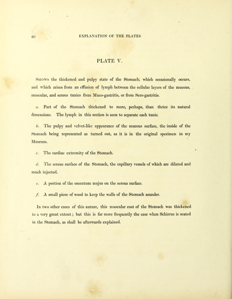 40 PLATE V. Shoavs the thickened and pulpy state of the Stomach; which occasionally occurs, and which arises from an effusion of lymph between the cellular layers of the mucous, muscular, and serous tunics from Muco-gastritis, or from Sero-gastritis. a. Part of the Stomach thickened to more, perhaps, than thrice its natural dimensions. The lymph in this section is seen to separate each tunic. b. The pulpy and velvet-like appearance of the mucous surface, the inside of the Stomach being represented as turned out, as it is in the original specimen in my f Museum. c. The cardiac extremity of the Stomach. d. The serous surface of the Stomach, the capillary vessels of which are dilated and much injected. e. A portion of the omentum majus on the serous surface. f A small piece of wood to keep the walls of the Stomach asunder. In two other cases of this nature, this muscular coat of the Stomach was thickened to a very great extent; but this is far more frequently the case when Schirrus is seated in the Stomach, as shall be afterwards explained.