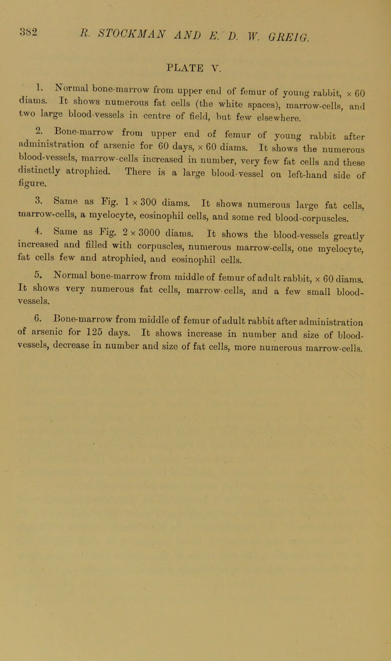 PLATE V. 1. Normal bone-marrow from upper end of femur of young rabbit, x 60 diams. It shows numerous fat cells (the white spaces), marrow-cells, and two large blood-vessels in centre of field, but few elsewhere. 2. Bone-marrow from upper end of femur of young rabbit after administration of arsenic for 60 days, x 60 diams. It shows the numerous blood-vessels, marrow-cells increased in number, very few fat cells and these distinctly atrophied. There is a large blood-vessel on left-hand side of figure. 3. Same as Pig. 1 x 300 diams. It shows numerous large fat cells, marrow-cells, a myelocyte, eosinophil cells, and some red blood-corpuscles. 4. Same as Fig. 2 x 3000 diams. It shows the blood-vessels greatly increased and filled with corpuscles, numerous marrow-cells, one myelocyte, fat cells few and atrophied, and eosinophil cells. 5. Normal bone-marrow from middle of femur of adult rabbit, x 60 diams. It shows very numerous fat cells, marrow-cells, and a few small blood- vessels, 6. Bone-marrow from middle of femur of adult rabbit after administration of arsenic for 125 days. It shows increase in number and size of blood- vessels, decrease in numbez’ and size of fat cells, more numerous marrow-cells.