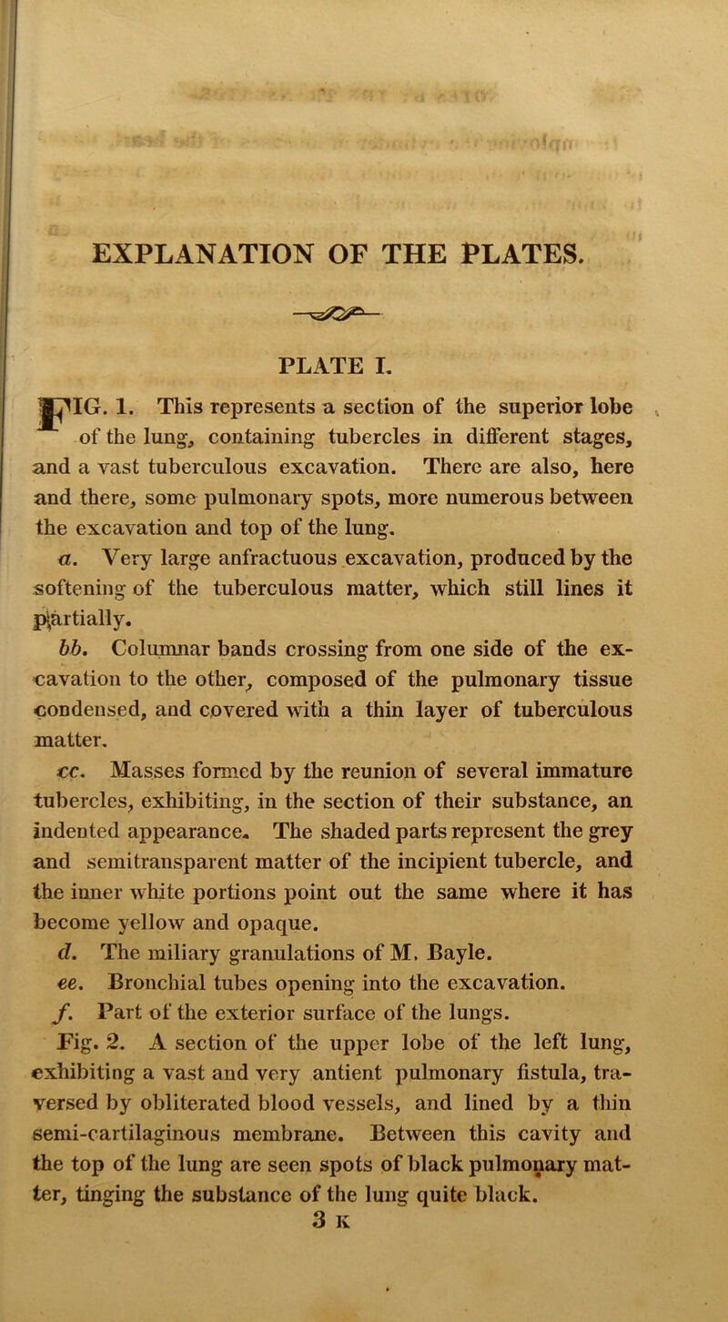 PLATE I. This represents a section of the superior lobe of the lung, containing tubercles in different stages, and a vast tuberculous excavation. There are also, here and there, some pulmonary spots, more numerous between the excavation and top of the lung. u. Very large anfractuous excavation, produced by the softening of the tuberculous matter, which still lines it p|artially. bb. Columnar bands crossing from one side of the ex- cavation to the other^ composed of the pulmonary tissue condensed, and covered with a thin layer of tuberculous matter. cc. Masses formed by the reunion of several immature tubercles, exhibiting, in the section of their substance, an indented appearance* The shaded parts represent the grey and semitransparent matter of the incipient tubercle, and the inner white portions point out the same where it has become yellow and opaque. d. The miliary granulations of M. Bayle. ee. Bronchial tubes opening into the excavation. f. Part of the exterior surface of the lungs. Fig. 2. A section of the upper lobe of the left lung, exhibiting a vast and very antient pulmonary fistula, tra- versed by obliterated blood vessels, and lined by a thin semi-cartilaginous membrane. Between this cavity and the top of the lung are seen spots of black pulmonary mat- ter, tinging the substance of the lung quite black. 3 K