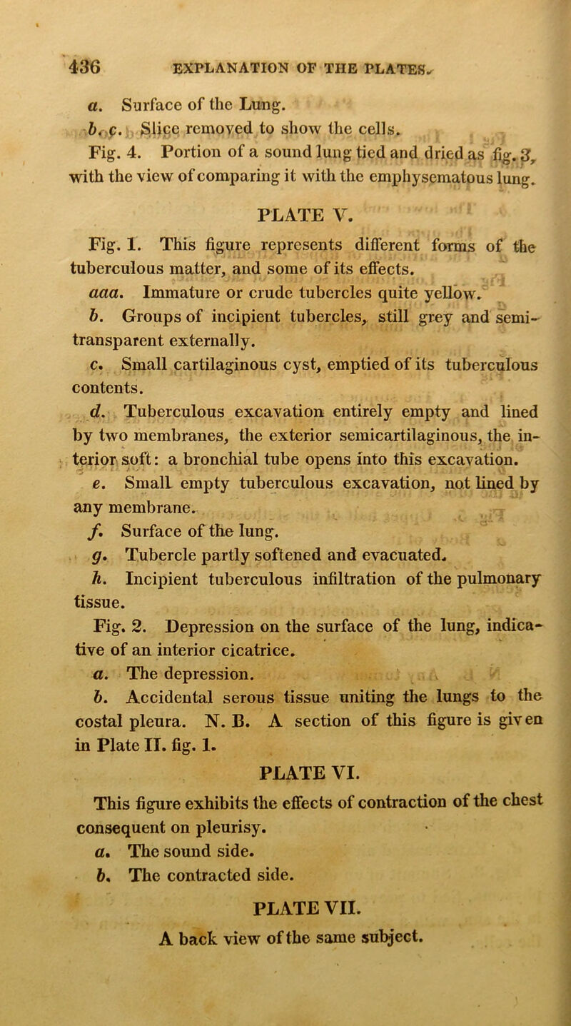 a. Surface of the Lung. ^lice removed to show the cells. Fig. 4. Portion of a sound lung tied and dried as fig. 3^ with the view of comparing it with the emphysematous lung. PLATE V. Fig. I. This figure represents different forms of the tuberculous matter, and some of its effects. aaa. Immature or crude tubercles quite yellow. b. Groups of incipient tubercles,^ still grey and semi- transparent externally. c. Small cartilaginous cyst, emptied of its tuberculous contents. d. Tuberculous excavation entirely empty and lined by two membranes, the exterior semicartilaginous, the in- terior soft: a bronchial tube opens into this excavation. e. Small empty tuberculous excavation, not lined by any membrane. f. Surface of the lung. g» Tubercle partly softened and evacuated. h. Incipient tuberculous infiltration of the pulmonary tissue. Fig. 2. Depression on the surface of the lung, indica- tive of an interior cicatrice. а. The depression. б. Accidental serous tissue uniting the lungs to the costal pleura. N. B. A section of this figure is giv en in Plate II. fig. 1. PLATE VI. This figure exhibits the effects of contraction of the chest consequent on pleurisy. а. The sound side. б. The contracted side. PLATE VII. A back view of the same sulyect.