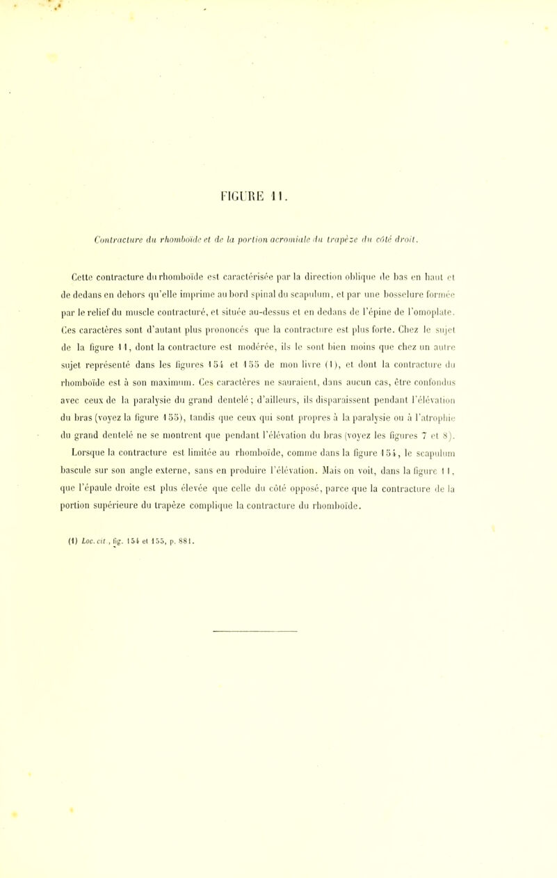 Contracture du rhomboïde et de la portion acromiale du trapèze du côté droit. Cette contracture du rhomboïde est caractérisée par la direction oblique de bas en haut et de dedans en dehors qu’elle imprime au bord spinal du scapulum, et par une bosselure formée par le relief du muscle contracturé, et située au-dessus et en dedans de l’épine de l’omoplate. Ces caractères sont d’autant plus prononcés que la contracture est plus forte. Chez le sujet de la figure 11, dont la contracture est modérée, ils le sont bien moins que chez un autre sujet représenté dans les figures 154 et 155 de mon livre (I), et dont la contracture du rhomboïde est à son maximum. Ces caractères ne sauraient, dans aucun cas, être confondus avec ceux de la paralysie du grand dentelé; d’ailleurs, ils disparaissent pendant l’élévation du bras (voyez la figure 1 55), tandis que ceux qui sont propres à la paralysie ou à l’atrophie du grand dentelé ne se montrent que pendant l’élévation du bras (voyez les figures 7 et 8). Lorsque la contracture est limitée au rhomboïde, comme dans la figure loi, le scapulum bascule sur son angle externe, sans en produire l’élévation. Mais on voit, dans la figure t I, que l’épaule droite est plus élevée que celle du côté opposé, parce que la contracture de la portion supérieure du trapèze complique la contracture du rhomboïde. (1) hoc. cilfig. I 54 et 155, p. 881.