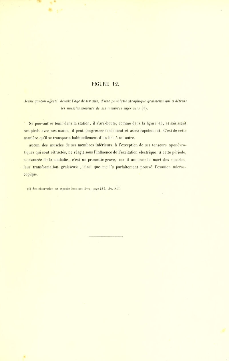 Jeune garçon affecté, depuis l'dge de six ans, d’une paralysie atrophique graisseuse qui a détruit les muscles moteurs de ses membres inférieurs (1). Ne pouvant se tenir dans la station, il s’arc-boute, comme dans la figure 1 3, et saisissant ses pieds avec ses mains, il peut progresser facilement et assez rapidement. C’est de cette manière qu’il se transporte habituellement d’un lieu à un autre. Aucun des muscles de ses membres inférieurs, à l’exception de ses tenseurs aponévro- tiques qui sont rétractés, ne réagit sous l'influence de l’excitation électrique. A cette période, si avancée de la maladie, c’est un pronostic grave, car il annonce la mort des muscles, leur transformation, graisseuse , ainsi que me l’a parfaitement prouvé l’examen micros- copique.