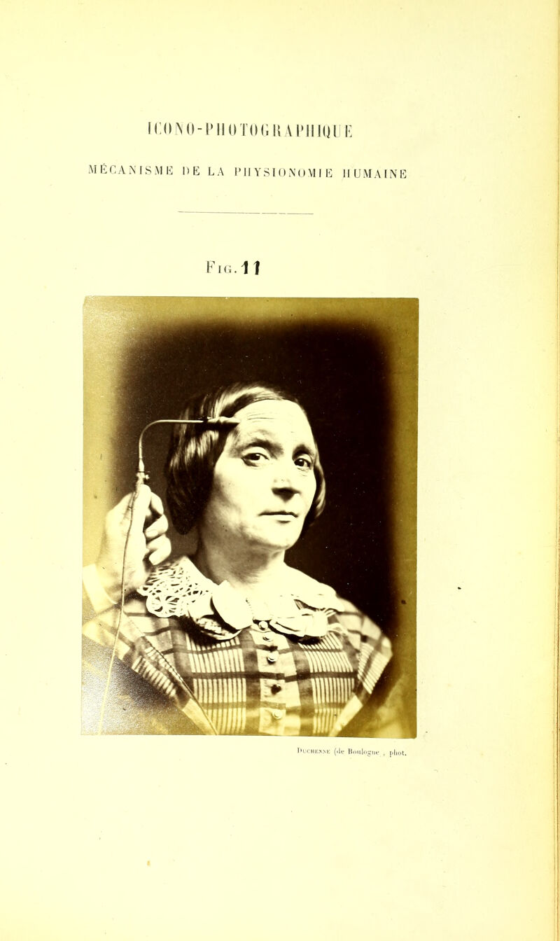 ICOJNO-P IIOTOGJUNIIQU G MÉCANISME DE LA PHYSIONOMIE HUMAINE Fig.11