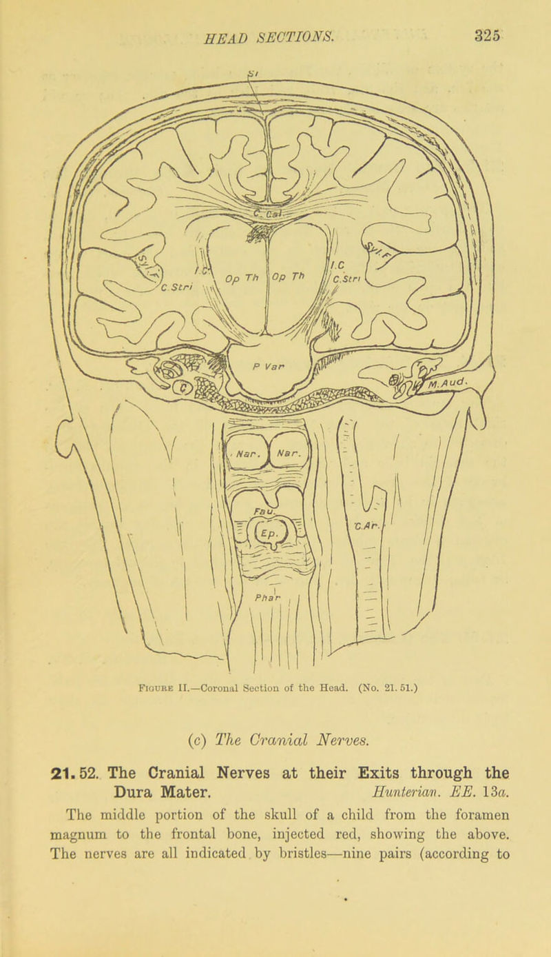 (c) The Cranial Nerves. 21.52. The Cranial Nerves at their Exits through the Dura Mater. Hunterian. EE. 13a. The middle portion of the skull of a child from the foramen magnum to the frontal bone, injected red, showing the above. The nerves are all indicated by bristles—nine pairs (according to