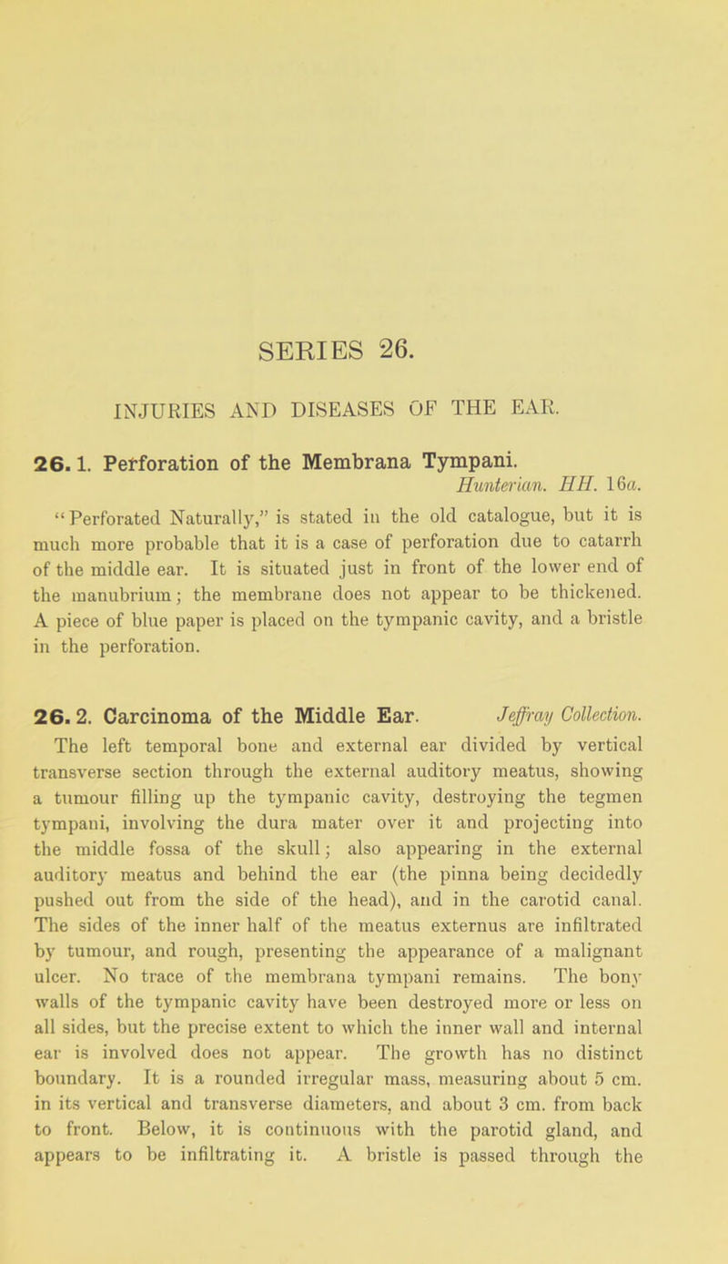 INJURIES AND DISEASES OF THE EAR. 26.1. Petforation of the Membrana Tympani. Hunterian. HH. 16a. “ Perforated Naturally,” is stated in the old catalogue, but it is much more probable that it is a case of perforation due to catarrh of the middle ear. It is situated just in front of the lower end of the manubrium; the membrane does not appear to be thickened. A piece of blue paper is placed on the tympanic cavity, and a bristle in the perforation. 26.2. Carcinoma of the Middle Ear. Jeffrey Collection. The left temporal bone and external ear divided by vertical transverse section through the external auditory meatus, showing a tumour filling up the tympanic cavity, destroying the tegmen tympani, involving the dura mater over it and projecting into the middle fossa of the skull; also appearing in the external auditor}’ meatus and behind the ear (the pinna being decidedly pushed out from the side of the head), and in the carotid canal. The sides of the inner half of the meatus externus are infiltrated by tumour, and rough, presenting the appearance of a malignant ulcer. No trace of the membrana tympani remains. The bony walls of the tympanic cavity have been destroyed more or less on all sides, but the precise extent to which the inner wall and internal ear is involved does not appear. The growth has no distinct boundary. It is a rounded irregular mass, measuring about 5 cm. in its vertical and transverse diameters, and about 3 cm. from back to front. Below, it is continuous with the parotid gland, and appears to be infiltrating it. A bristle is passed through the