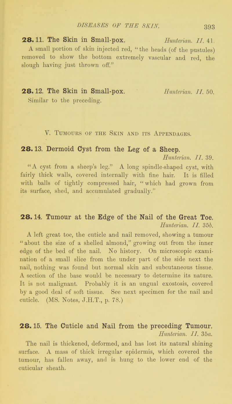 DISEASES OF THE SKIN. 28.11. The Skin in Small-pox. Huntman. II. 41. A small portion of skin injected red, “ the heads (of the pustules) removed to show the bottom extremely vascular and red, the slough having just thrown off.” 28.12. The Skin in Small-pox. Hunterian. II. 50. Similar to the preceding. V. Tumours of the Skin and its Appendages. 28.13. Dermoid Cyst from the Leg of a Sheep. Hunterian. II. 39. “A cyst from a sheep’s leg.” A long spindle-shaped cyst, with fairly thick walls, covered internally with fine hair. It is filled with balls of tightly compressed hair, “which had grown from its surface, shed, and accumulated gradually.” 28.14. Tumour at the Edge of the Nail of the Great Toe. Hunterian. II. 35b. A left great toe, the cuticle and nail removed, showing a tumour “ about the size of a shelled almond,” growing out from the inner edge of the bed of the nail. No history. On microscopic exami- nation of a small slice from the under part of the side next the nail, nothing was found but normal skin and subcutaneous tissue. A section of the base would be necessary to determine its nature. It is not malignant. Probably it is an ungual exostosis, covered by a good deal of soft tissue. See next specimen for the nail and cuticle. (MS. Notes, J.H.T., p. 78.) 28.15. The Cuticle and Nail from the preceding Tumour. Hunterian. II. 35a. The nail is thickened, deformed, and has lost its natural shining surface. A mass of thick irregular epidermis, which covered the tumour, has fallen away, and is hung to the lower end of the cuticular sheath.