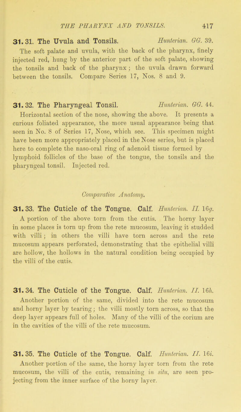 31.31. The Uvula and Tonsils. Hunterian. GG. 39. The soft palate and uvula, with the back of the pharynx, finely injected red, hung by the anterior part of the soft palate, showing the tonsils and back of the pharynx; the uvula drawn forward between the tonsils. Compare Series 17, Nos. 8 and 9. 31.32. The Pharyngeal Tonsil. Hunterian. GG. 44. Horizontal section of the nose, showing the above. It presents a curious foliated appearance, the more usual appearance being that seen in No. 8 of Series 17, Nose, which see. This specimen might have been more appropriately placed in the Nose series, but is placed here to complete the naso-oral ring of adenoid tissue formed by lymphoid follicles of the base of the tongue, the tonsils and the pharyngeal tonsil. Injected red. Comparative Anatomy. 31.33. The Cuticle of the Tongue. Calf. Hunterian. II. lC^r. A portion of the above torn from the cutis. The horny layer in some places is torn up from the rete mucosum, leaving it studded with villi; in others the villi have torn across and the rete mucosum appears perforated, demonstrating that the epithelial villi are hollow, the hollows in the natural condition being occupied by the villi of the cutis. 31.34. The Cuticle of the Tongue. Calf. Hunterian. II. 16h. Another portion of the same, divided into the rete mucosum and horny layer by tearing; the villi mostly torn across, so that the deep layer appears full of holes. Many of the villi of the corium are in the cavities of the villi of the rete mucosum. 31.35. The Cuticle of the Tongue. Calf. Hunterian. II. 16i. Another portion of the same, the horny layer torn from the rete mucosum, the villi of the cutis, remaining in situ, are seen pro- jecting from the inner surface of the horny layer.