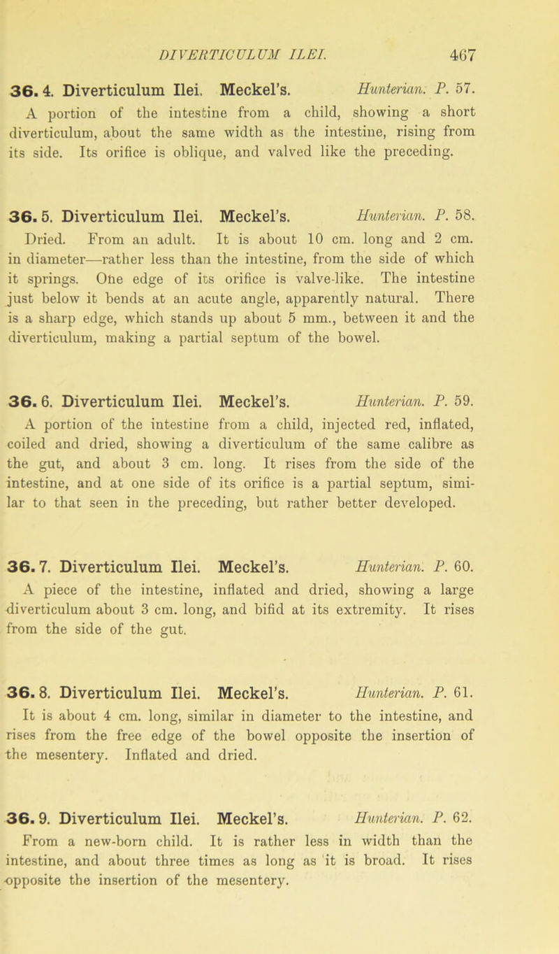 36.4. Diverticulum Ilei. Meckel’s. Hunterian. P.57. A portion of the intestine from a child, showing a short diverticulum, about the same width as the intestine, rising from its side. Its orifice is oblique, and valved like the preceding. 36. 5. Diverticulum Ilei. Meckel’s. Hunterian. P. 58. Dried. From an adult. It is about 10 cm. long and 2 cm. in diameter—rather less than the intestine, from the side of which it springs. One edge of its orifice is valve-like. The intestine just below it bends at an acute angle, apparently natural. There is a sharp edge, which stands up about 5 mm., between it and the diverticulum, making a partial septum of the bowel. 36. 6. Diverticulum Ilei. Meckel’s. Hunterian. P. 59. A portion of the intestine from a child, injected red, inflated, coiled and dried, showing a diverticulum of the same calibre as the gut, and about 3 cm. long. It rises from the side of the intestine, and at one side of its orifice is a partial septum, simi- lar to that seen in the preceding, but rather better developed. 36.7. Diverticulum Ilei. Meckel’s. Hunterian. P. 60. A piece of the intestine, inflated and dried, showing a large diverticulum about 3 cm. long, and bifid at its extremity. It rises from the side of the gut. 36.8. Diverticulum Ilei. Meckel’s. Hunterian. P. 61. It is about 4 cm. long, similar in diameter to the intestine, and rises from the free edge of the bowel opposite the insertion of the mesentery. Inflated and dried. 36.9. Diverticulum Ilei. Meckel’s. Hunterian. P. 62. From a new-born child. It is rather less in width than the intestine, and about three times as long as it is broad. It rises -opposite the insertion of the mesentery.