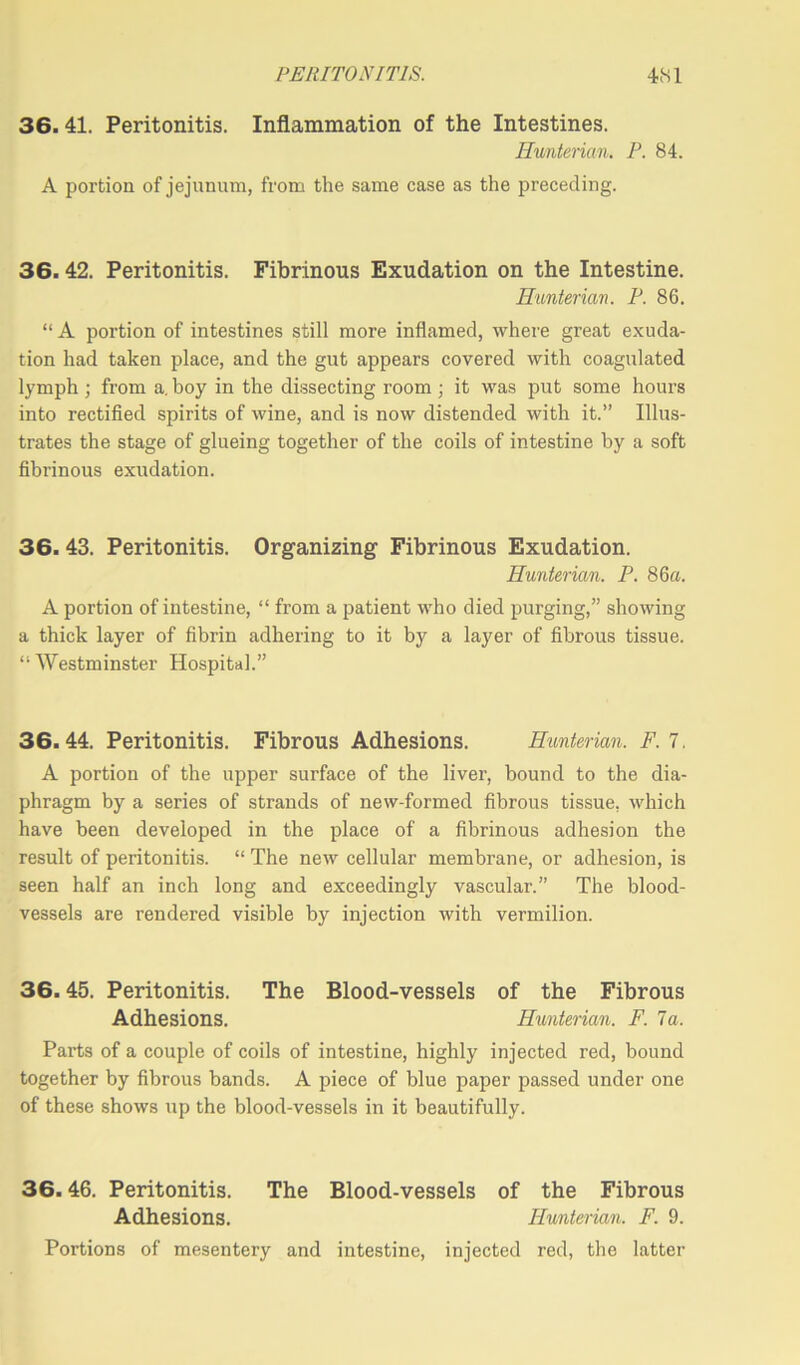 36.41. Peritonitis. Inflammation of the Intestines. Hunterian. P. 84. A portion of jejunum, from the same case as the preceding. 36.42. Peritonitis. Fibrinous Exudation on the Intestine. Hunterian. P. 86. “ A portion of intestines still more inflamed, where great exuda- tion had taken place, and the gut appears covered with coagulated lymph; from a. boy in the dissecting room; it was put some hours into rectified spirits of wine, and is now distended with it.” Illus- trates the stage of glueing together of the coils of intestine by a soft fibrinous exudation. 36. 43. Peritonitis. Organizing Fibrinous Exudation. Hunterian. P. 86a. A portion of intestine, “ from a patient who died purging,” showing a thick layer of fibrin adhering to it by a layer of fibrous tissue. “Westminster Hospital.” 36.44. Peritonitis. Fibrous Adhesions. Hunterian. F. 7. A portion of the upper surface of the liver, bound to the dia- phragm by a series of strands of new-formed fibrous tissue, which have been developed in the place of a fibrinous adhesion the result of peritonitis. “ The new cellular membrane, or adhesion, is seen half an inch long and exceedingly vascular.” The blood- vessels are rendered visible by injection with vermilion. 36.45. Peritonitis. The Blood-vessels of the Fibrous Adhesions. Hunterian. F. la. Parts of a couple of coils of intestine, highly injected red, bound together by fibrous bands. A piece of blue paper passed under one of these shows up the blood-vessels in it beautifully. 36.46. Peritonitis. The Blood-vessels of the Fibrous Adhesions. I-Iunterian. F. 9. Portions of mesentery and intestine, injected red, the latter