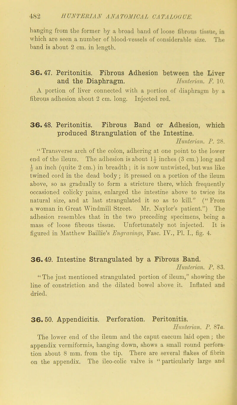 hanging from the former by a broad band of loose fibrous tissue, in which are seen a number of blood-vessels of considerable size. The band is about 2 cm. in length. 36. 47. Peritonitis. Fibrous Adhesion between the Liver and the Diaphragm. Hunterian. F. 10. A portion of liver connected with a portion of diaphragm by a fibrous adhesion about 2 cm. long. Injected red. 36.48. Peritonitis. Fibrous Band or Adhesion, which produced Strangulation of the Intestine. Hunterian. P. 28. “Transverse arch of the colon, adhering at one point to the lower end of the ileum. The adhesion is about 1^ inches (3 cm.) long and I an inch (quite 2 cm.) in breadth ; it is now untwisted, but was like twined cord in the dead body ; it pressed on a portion of the ileum above, so as gradually to form a stricture there, which frequent!}' occasioned colicky pains, enlarged the intestine above to twice its natural size, and at last strangulated it so as to kill.” (“From a woman in Great Windmill Street. Mr. Naylor’s patient.”) The adhesion resembles that in the two preceding specimens, being a mass of loose fibrous tissue. Unfortunately not injected. It is figured in Matthew Baillie’s Engravings, Fasc. IV., PI. I., fig. 4. 36.49. Intestine Strangulated by a Fibrous Band. Hunterian. P. 83. “The just mentioned strangulated portion of ileum,” showing the line of constriction and the dilated bowel above it. Inflated and dried. 36.50. Appendicitis. Perforation. Peritonitis. Hunterian. P. 87a. The lower end of the ileum and the caput caecum laid open; the appendix vermiformis, hanging down, shows a small round perfora- tion about 8 mm. from the tip. There are several flakes of fibrin on the appendix. The ileo-colic valve is “ particularly large and