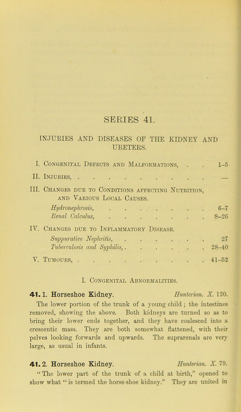 SERIES 41. INJURIES AND DISEASES OF THE KIDNEY AND URETERS. I. Congenital Defects and Malformations, . . 1-5 II. Injuries, III. Changes due to Conditions affecting Nutrition, and Various Local Causes. Hydronephrosis, ...... 6-7 Renal Calculus, . 8-26 IV. Changes due to Inflammatory Disease. Suppurative Nephritis, . ... . 27 Tuberculosis and Syphilis,. ... . . 28-40 V. Tumours, ■ . . 41-52 I. Congenital Abnormalities. 41.1. Horseshoe Kidney. Hunterian. X. 120. The lower portion of the trunk of a young child ; the intestines removed, showing the above. Both kidneys are turned so as to bring their lower ends together, and they have coalesced into a crescentic mass. They are both somewhat flattened, with their pelves looking forwards and upwards. The suprarenals are very large, as usual in infants. 41.2. Horseshoe Kidney. Hunterian. X. 79. “ The lower part of the trunk of a child at birth,” opened to show what “ is termed the horse-shoe kidney.” They are united in
