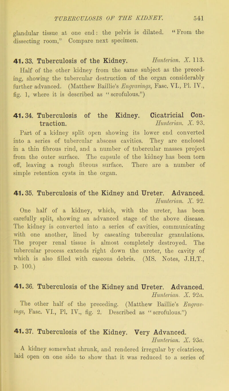 glandular tissue at one end: the pelvis is dilated. “ From the dissecting room.” Compare next specimen. 41.33. Tuberculosis of the Kidney. Hunterian. X. 113. Half of the other kidney from the same subject as the preced- ing, showing the tubercular destruction of the organ considerably further advanced. (Matthew Baillie’s Engravings, Fasc. VI., PI. IV., fig. 1, where it is described as “ scrofulous.”) 41.34. Tuberculosis of the Kidney. Cicatricial Con- traction. Hunterian. X. 93. Part of a kidney split open showing its lower end converted into a series of tubercular abscess cavities. They are enclosed in a thin fibrous rind, and a number of tubercular masses project from the outer surface. The capsule of the kidney has been torn off, leaving a rough fibrous surface. There are a number of simple retention cysts in the organ. 41.35. Tuberculosis of the Kidney and Ureter. Advanced. Hunterian. X. 92. One half of a kidney, which, with the ureter, has been carefully split, showing an advanced stage of the above disease. The kidney is converted into a series of cavities, communicating with one another, lined by caseating tubercular granulations. The proper renal tissue is almost completely destroyed. The tubercular process extends right down the ureter, the cavity of which is also filled with caseous debris. (MS. Notes, J.H.T., p. 100.) 41.36. Tuberculosis of the Kidney and Ureter. Advanced. Hunterian. X. 92a. The other half of the preceding. (Matthew Baillie’s Engrav- ings, Fasc. VI., PI. IV., fig. 2. Described as “ scrofulous.”) 41.37. Tuberculosis of the Kidney. Very Advanced. Hunterian. X. 93a. A kidney somewhat shrunk, and rendered irregular by cicatrices, laid open on one side to show that it was reduced to a series of