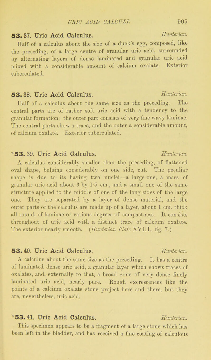 53.37. Uric Acid Calculus. Hunterian. Half of a calculus about the size of a duck’s egg, composed, like the preceding, of a large centre of granular uric acid, surrounded by alternating layers of dense laminated and granular uric acid mixed with a considerable amount of calcium oxalate. Exterior tuberculated. 53. 38. Uric Acid Calculus. Hunterian. Half of a calculus about the same size as the preceding. The central parts are of rather soft uric acid with a tendency to the granular formation; the outer part consists of very fine wavy laminae. The central parts show a trace, and the outer a considerable amount, of calcium oxalate. Exterior tuberculated. *53. 39. Uric Acid Calculus. Hunterian. A calculus considerably smaller than the preceding, of flattened oval shape, bulging considerably on one side, cut. The peculiar shape is due to its having two nuclei—a large one, a mass of granular uric acid about 3 by T5 cm., and a small one of the same structure applied to the middle of one of the long sides of the large one. They are separated by a layer of dense material, and the outer parts of the calculus are made up of a layer, about 1 cm. thick all round, of laminae of various degrees of compactness. It consists throughout of uric acid with a distinct trace of calcium oxalate. The exterior nearly smooth. (Hunterian Plate XVIII., fig. 7.) 53. 40. Uric Acid Calculus. Hunterian. A calculus about the same size as the preceding. It has a centre of laminated dense uric acid, a granular layer which shows traces of oxalates, and, externally to that, a broad zone of very dense finely laminated uric acid, nearly pure. Rough excrescences like the points of a calcium oxalate stone project here and there, but they are, nevertheless, uric acid. *53.41. Uric Acid Calculus. Hunterian. This specimen appears to be a fragment of a large stone which has been left in the bladder, and has received a fine coating of calculous