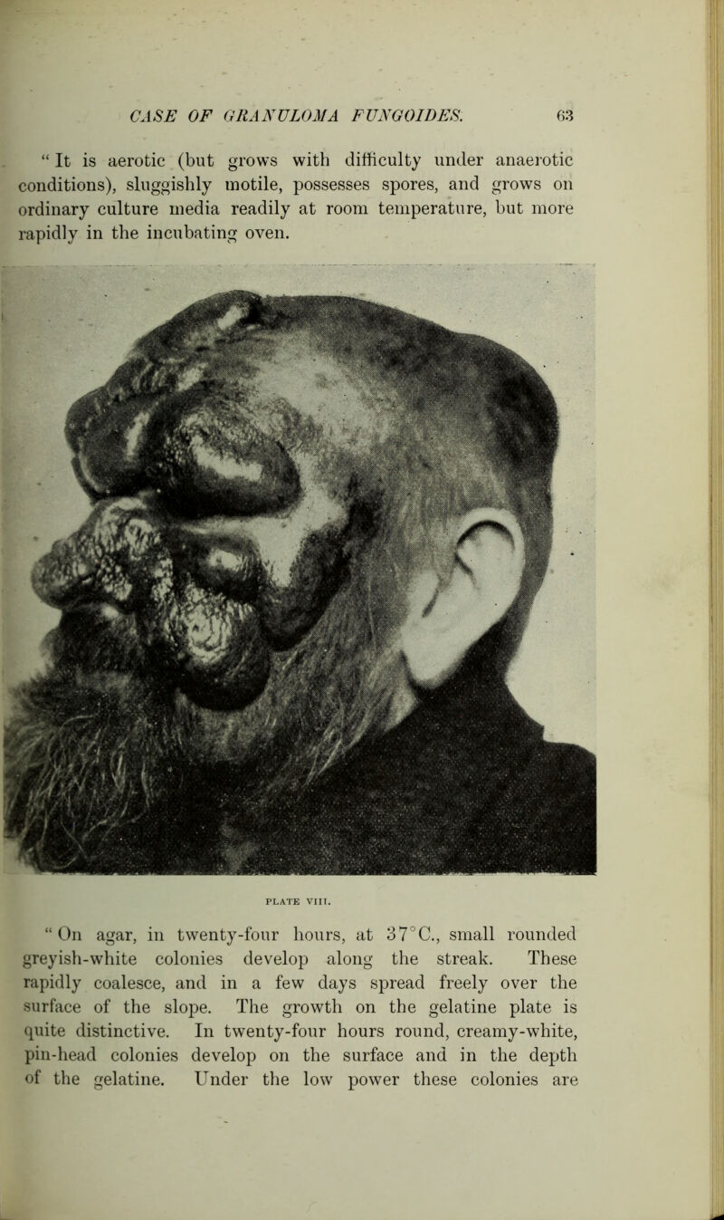 “ It is aerotic (but grows with difficulty under anaerotic conditions), sluggishly motile, possesses spores, and grows on ordinary culture media readily at room temperature, but more rapidly in the incubating oven. PLATE VIII. “On agar, in twenty-four hours, at 37°C., small rounded greyish-white colonies develop along the streak. These rapidly coalesce, and in a few days spread freely over the surface of the slope. The growth on the gelatine plate is quite distinctive. In twenty-four hours round, creamy-white, pin-head colonies develop on the surface and in the depth of the gelatine. Under the low power these colonies are