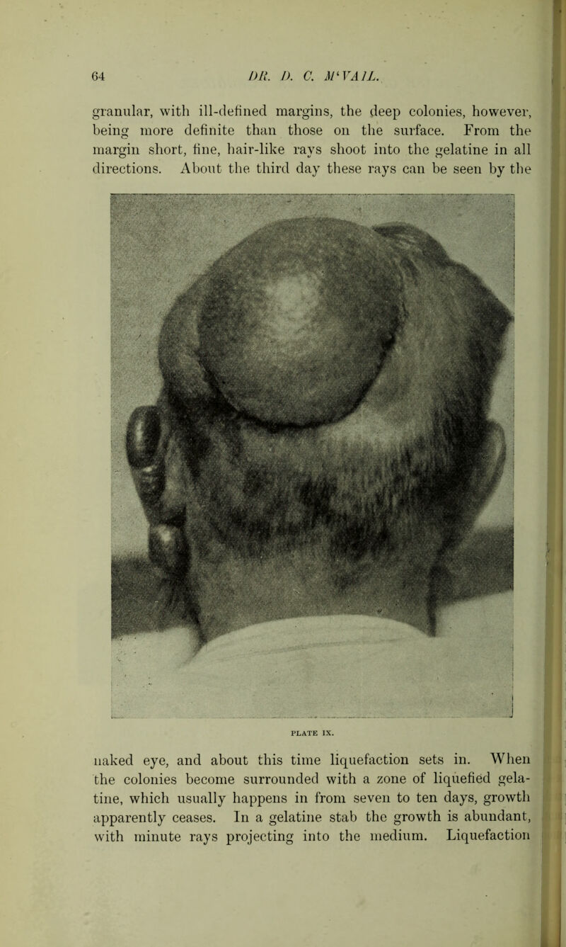 granular, with ill-defined margins, the deep colonies, however, being more definite than those on the surface. From the margin short, fine, hair-like rays shoot into the gelatine in all directions. About the third day these rays can be seen by the I j PLATE IX. naked eye, and about this time liquefaction sets in. When the colonies become surrounded with a zone of liquefied gela- tine, which usually happens in from seven to ten days, growth apparently ceases. In a gelatine stab the growth is abundant, with minute rays projecting into the medium. Liquefaction