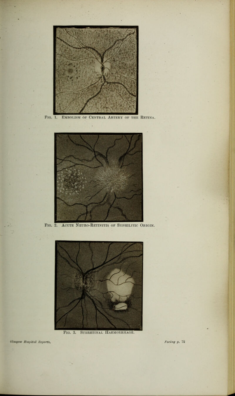 Glasgow Hospital Reports, Facing p. 72