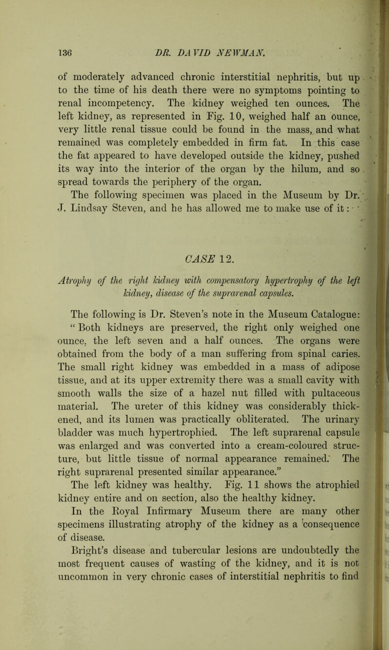 of moderately advanced chronic interstitial nephritis, but up to the time of his death there were no symptoms pointing to renal incompetency. The kidney weighed ten ounces. The left kidney, as represented in Fig. 10, weighed half an ounce, very little renal tissue could be found in the mass, and what remained was completely embedded in firm fat. In this case the fat appeared to have developed outside the kidney, pushed its way into the interior of the organ by the hilum, and so spread towards the periphery of the organ. The following specimen was placed in the Museum by Dr. J. Lindsay Steven, and he has allowed me to make use of it: • CASE 12. Atrophy of the right kidney with compensatory hypertrophy of the left kidney, disease of the suprarenal capsules. The following is Dr. Steven’s note in the Museum Catalogue: “ Both kidneys are preserved, the right only weighed one ounce, the left seven and a half ounces. The organs were obtained from the body of a man suffering from spinal caries. The small right kidney was embedded in a mass of adipose tissue, and at its upper extremity there was a small cavity with smooth walls the size of a hazel nut filled with pultaceous material. The ureter of this kidney was considerably thick- ened, and its lumen was practically obliterated. The urinary bladder was much hypertrophied. The left suprarenal capsule was enlarged and was converted into a cream-coloured struc- ture, but little tissue of normal appearance remained; The right suprarenal presented similar appearance.” The left kidney was healthy. Fig. 11 shows the atrophied kidney entire and on section, also the healthy kidney. In the Koyal Infirmary Museum there are many other specimens illustrating atrophy of the kidney as a Consequence of disease. Bright’s disease and tubercular lesions are undoubtedly the most frequent causes of wasting of the kidney, and it is not uncommon in very chronic cases of interstitial nephritis to find