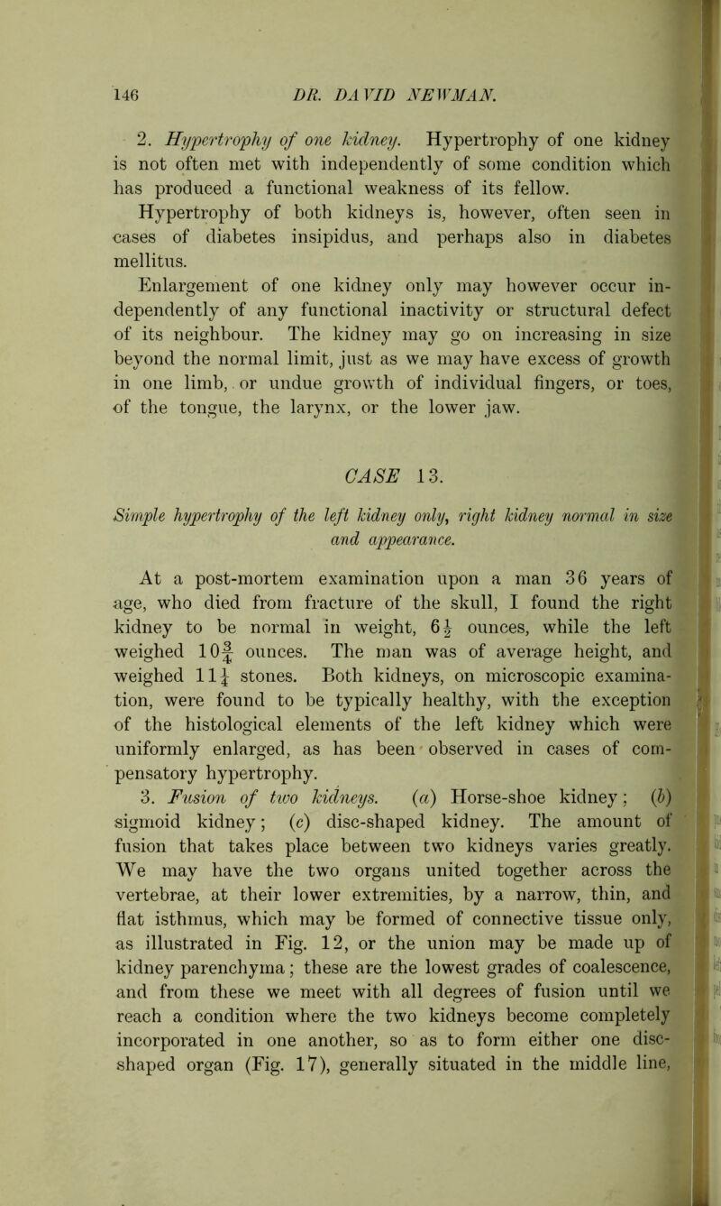 2. Hypertrophy of one kidney. Hypertrophy of one kidney is not often met with independently of some condition which has produced a functional weakness of its fellow. Hypertrophy of both kidneys is, however, often seen in cases of diabetes insipidus, and perhaps also in diabetes mellitus. Enlargement of one kidney only may however occur in- dependently of any functional inactivity or structural defect of its neighbour. The kidney may go on increasing in size beyond the normal limit, just as we may have excess of growth in one limb, or undue growth of individual fingers, or toes, of the tongue, the larynx, or the lower jaw. CASE 13. Simple hypertrophy of the left kidney only, right kidney normal in size and appearance. At a post-mortem examination upon a man 36 years of age, who died from fracture of the skull, I found the right kidney to be normal in weight, 6J ounces, while the left weighed 10^ ounces. The man was of average height, and weighed 11J stones. Both kidneys, on microscopic examina- tion, were found to be typically healthy, with the exception of the histological elements of the left kidney which were uniformly enlarged, as has been observed in cases of com- pensatory hypertrophy. 3. Fusion of two kidneys. (a) Horse-shoe kidney; (b) sigmoid kidney; (c) disc-shaped kidney. The amount of fusion that takes place between two kidneys varies greatly. We may have the two organs united together across the vertebrae, at their lower extremities, by a narrow, thin, and flat isthmus, which may be formed of connective tissue only, as illustrated in Fig. 12, or the union may be made up of kidney parenchyma; these are the lowest grades of coalescence, and from these we meet with all degrees of fusion until we reach a condition where the two kidneys become completely incorporated in one another, so as to form either one disc- shaped organ (Fig. 17), generally situated in the middle line, I I ■ it • ■ ‘ i : I n I ti |D( I I - I 9 if(|i
