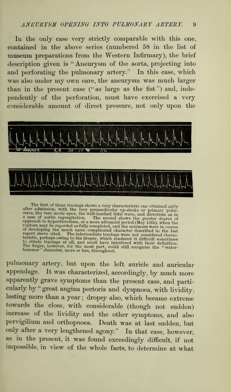 In the only case very strictly comparable with this one, contained in the above series (numbered 58 in the list of museum preparations from the Western Infirmary), the brief description given is “ Aneurysm of the aorta, projecting into -and perforating the pulmonary artery.” In this case, which was also under my own care, the aneurysm was much larger than in the present case (“ as large as the fist ”) and, inde- pendently of the perforation, must have exercised a very considerable amount of direct pressure, not only upon the The first of these tracings shows a very characteristic one obtained early after admission, with the very perpendicular up-stroke or primary pulse- wave, the very acute apex, the well-marked tidal wave, and dicrotism as in a case of aortic regurgitation. The second shows the greater degree of approach to hyperdicrotism, at a more advanced period (May 12th), when the rupture may be regarded as fully completed, and the murmurs were in course of developing the much more complicated character described in the last report above cited. The intermediate tracings were not considered charac- teristic, perhaps owing to the dropsy, which rendered it difficult sometimes to obtain tracings at all, and must have interfered with their definition. The finger, however, for the most part, could still recognize the “water- hammer character, more or less, throughout. pulmonary artery, but upon the left auricle and auricular appendage. It was characterized, accordingly, by much more apparently grave symptoms than the present case, and parti- cularly by “ great angina pectoris and dyspnoea, with lividity, lasting more than a year; dropsy also, which became extreme towards the close, with considerable (though not sudden) increase of the lividity and the other symptoms, and also pervigilium and orthopnoea. Death was at last sudden, but only after a very lengthened agony.” In that case, however, as in the present, it was found exceedingly difficult, if not impossible, in view of the whole facts, to determine at what