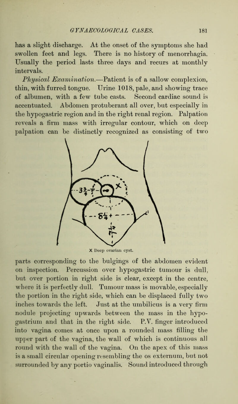 has a slight discharge. At the onset of the symptoms she had swollen feet and legs. There is no history of menorrhagia. Usually the period lasts three days and recurs at monthly intervals. Physical Examination.—Patient is of a sallow complexion, thin, with furred tongue. Urine 1018, pale, and showing trace of albumen, with a few tube casts. Second cardiac sound is accentuated. Abdomen protuberant all over, but especially in the hypogastric region and in the right renal region. Palpation reveals a firm mass with irregular contour, which on deep palpation can be distinctly recognized as consisting of two parts corresponding to the bulgings of the abdomen evident on inspection. Percussion over hypogastric tumour is dull, but over portion in right side is clear, except in the centre, where it is perfectly dull. Tumour mass is movable, especially the portion in the right side, which can be displaced fully two inches towards the left. Just at the umbilicus is a very firm nodule projecting upwards between the mass in the hypo- gastrium and that in the right side. P.V. finger introduced into vagina comes at once upon a rounded mass filling the upper part of the vagina, the wall of which is continuous all round with the wall of the vagina. On the apex of this mass is a small circular opening resembling the os externum, but not surrounded by any portio vaginalis. Sound introduced through