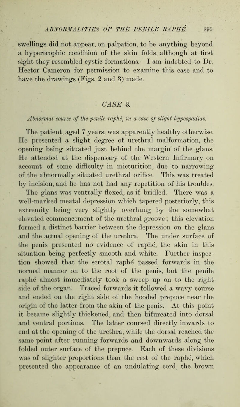 swellings did not appear, on palpation, to be anything beyond a hypertrophic condition of the skin folds, although at first sight they resembled cystic formations. I am indebted to Dr. Hector Cameron for permission to examine this case and to have the drawings (Figs. 2 and 3) made. CASE 3. Abnoi'mal course of the penile raplui, in a case of slight hypospadias. The patient, aged 7 years, was apparently healthy otherwise. He presented a slight degree of urethral malformation, the opening being situated just behind the margin of the glans. He attended at the dispensary of the Western Infirmary on account of some difficulty in micturition, due to narrowing of the abnormally situated urethral orifice. This was treated by incision, and he has not had any repetition of his troubles. The glans was ventrally flexed, as if bridled. There was a well-marked meatal depression which tapered posteriorly, this extremity being very slightly overhung by the somewhat elevated commencement of the urethral groove; this elevation formed a distinct barrier between the depression on the glans and the actual opening of the urethra. The under surface of the penis presented no evidence of raphe, the skin in this situation being perfectly smooth and white. Further inspec- tion showed that the scrotal raphe passed forwards in the normal manner on to the root of the penis, but the penile raphe almost immediately took a sweep up on to the right side of the organ. Traced forwards it followed a wavy course and ended on the right side of the hooded prepuce near the origin of the latter from the skin of the penis. At this point it became slightly thickened, and then bifurcated into dorsal and ventral portions. The latter coursed directly inwards to end at the opening of the urethra, while the dorsal reached the same point after running forwards and downwards along the folded outer surface of the prepuce. Each of these divisions was of slighter proportions than the rest of the raphe, which presented the appearance of an undulating cord, the brown