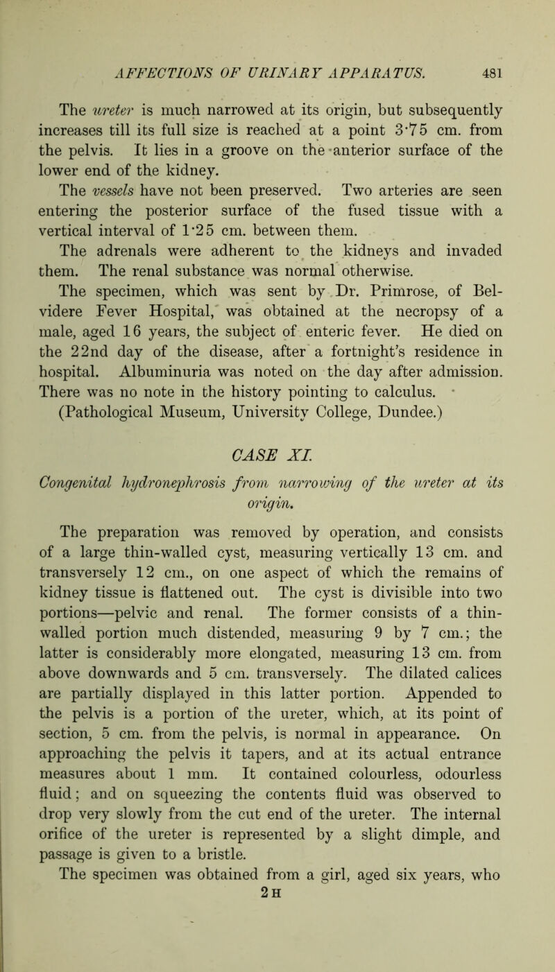 The ureter is much narrowed at its origin, but subsequently increases till its full size is reached at a point 3*75 cm. from the pelvis. It lies in a groove on the anterior surface of the lower end of the kidney. The vessels have not been preserved. Two arteries are seen entering the posterior surface of the fused tissue with a vertical interval of 1*25 cm. between them. The adrenals were adherent to the kidneys and invaded them. The renal substance was normal otherwise. The specimen, which was sent by Dr. Primrose, of Bel- videre Fever Hospital, was obtained at the necropsy of a male, aged 16 years, the subject of enteric fever. He died on the 22 nd day of the disease, after a fortnight’s residence in hospital. Albuminuria was noted on the day after admission. There was no note in the history pointing to calculus. (Pathological Museum, University College, Dundee.) CASE XI. Congenital hydronephrosis from narrowing of the ureter at its origin. The preparation was removed by operation, and consists of a large thin-walled cyst, measuring vertically 13 cm. and transversely 12 cm., on one aspect of which the remains of kidney tissue is flattened out. The cyst is divisible into two portions—pelvic and renal. The former consists of a thin- walled portion much distended, measuring 9 by 7 cm.; the latter is considerably more elongated, measuring 13 cm. from above downwards and 5 cm. transversely. The dilated calices are partially displayed in this latter portion. Appended to the pelvis is a portion of the ureter, which, at its point of section, 5 cm. from the pelvis, is normal in appearance. On approaching the pelvis it tapers, and at its actual entrance measures about 1 mm. It contained colourless, odourless fluid; and on squeezing the contents fluid was observed to drop very slowly from the cut end of the ureter. The internal orifice of the ureter is represented by a slight dimple, and passage is given to a bristle. The specimen was obtained from a girl, aged six years, who 2h