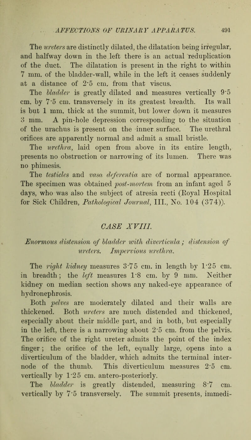 The ureters are distinctly dilated, the dilatation being irregular, and halfway down in the left there is an actual reduplication of the duct. The dilatation is present in the right to within 7 mm. of the bladder-wall, while in the left it ceases suddenly at a distance of 2*5 cm. from that viscus. The bladder is greatly dilated and measures vertically 9*5 cm. by 7'5 cm. transversely in its greatest breadth. Its wall is but 1 mm. thick at the summit, but lower down it measures 3 mm. A pin-hole depression corresponding to the situation of the urachus is present on the inner surface. The urethral orifices are apparently normal and admit a small bristle. The urethra, laid open from above in its entire length, presents no obstruction or narrowing of its lumen. There was no phimesis. The testicles and rasa deferentia are of normal appearance. The specimen was obtained post-mortem from an infant aged 5 days, who was also the subject of atresia recti (Royal Hospital for Sick Children, Pathological Journal, III., No. 104 (374)). CASE XVIII. Enormous distension of bladder with diverticula ; distension of ureters. Impervious urethra. The right kidney measures 3*75 cm. in length by 1*25 cm. in breadth; the left measures 1'8 cm. by 9 mm. Neither kidney on median section shows any naked-eye appearance of hydronephrosis. Both pelves are moderately dilated and their walls are thickened. Both ureters are much distended and thickened, especially about their middle part, and in both, but especially in the left, there is a narrowing about 2*5 cm. from the pelvis. The orifice of the right ureter admits the point of the index finger; the orifice of the left, equally large, opens into a diverticulum of the bladder, which admits the terminal inter- node of the thumb. This diverticulum measures 2-5 cm. vertically by 1*25 cm. antero-posteriorly. The bladder is greatly distended, measuring 8'7 cm. vertically by 7'5 transversely. The summit presents, immedi-