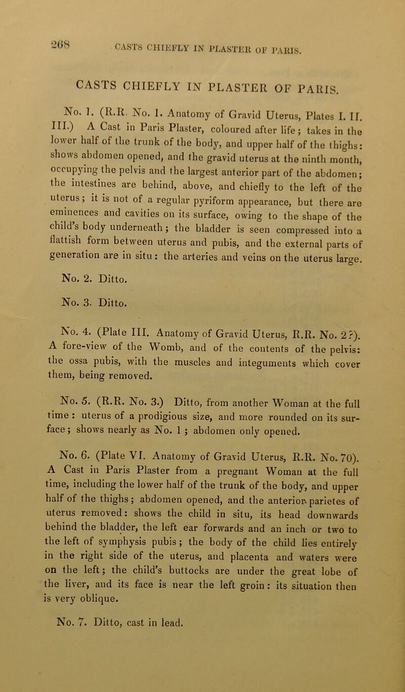 2(>8 CASTS CHIEFLY IN PLASTER OF PARIS. No. ]. (R.R, No. 1. Anatomy of Gravid Uterus, Plates I. II. III.) A Cast In Paris Plaster, coloured after life; takes In the lower half of the trunk of the body, and upper half of the thighs: shows abdomen opened, and the gravid uterus at the ninth month, occupying the pelvis and the largest anterior part of the abdomen; the intestines are behind, above, and chiefly to the left of the uterus; it is not of a regular pyriform appearance, but there are eminences and cavities on its surface, owing to the shape of the child s body underneath ; the bladder is seen compressed into a flattish form between uterus and pubis, and the external parts of generation are in situ: the arteries and veins on the uterus large. No. 2. Ditto. No. 3. Ditto. No. 4. (Plate III. Anatomy of Gravid Uterus, R.R. No. 2?). A foie-view of the W^omb, and of the contents of the pelvis: the ossa pubis, with tbe muscles and integuments which cover them, being removed. No. 5. (R.R. No. 3.) Ditto, from another Woman at the full time : uterus of a prodigious size, and more rounded on its sur- face ; shows nearly as No. 1 ; abdomen only opened. No. 6. (Plate VI. Anatomy of Gravid Uterus, R.R. No. 70). A Cast in Paris Plaster from a pregnant Woman at the full time, including the lower half of the trunk of the body, and upper half of the thighs; abdomen opened, and the anterior^parietes of uterus removed: shows the child in situ, its head downwards behind the bladder, the left ear forwards and an inch or two to the left of symphysis pubis; the body of the child lies entirely in the right side of the uterus, and placenta and waters were on the left; the child’s buttocks are under the great lobe of the liver, and its face is near the left groin : its situation then is very oblique. No. 7. Ditto, cast in lead.