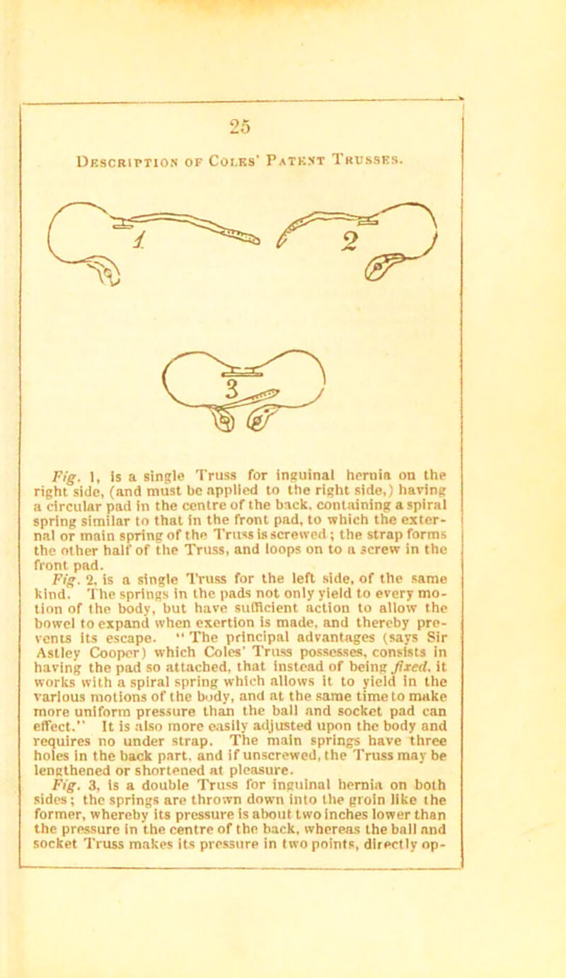 Drscbiition of Coi.ks' Patkxt Trusses. Fig. 1, Is a single Truss for inguinal hernia on the right side, (and must be applied to the right side,) having a circular pad in the centre of the bacli. containing a spiral spring similar to that in the front pad, to which the exter- nal or main spring of the Truss is screwed; the strap forms the other half of the Truss, and loops on to n screw in the front pad. Fig. 2. is a single Truss for the left side, of the same kind. The springs in the pads not only yield to every mo- tion of the body, but have suOicient action to allow the bowel to expand when exertion is made, and thereby pre- vents its escape. The principal advantages (says Sir Asticy Cooper) which Coles’ Tritss pos.sosses, consists in having the pad so attached, that instead of being fixed, it works with a spiral spring which allows it to yield in the various motions of the body, and at the same time to make more uniform pressure than the ball and socket pad can effect. It is also more c.'isily adjusted upon the body and requires no under strap. The main springs have three holes in the back part, and if unscrewed, the Truss may be lengthened or shortened at pleasure. Fig. 3, is a double Truss for Inguinal hernia on both sides; the springs are thrown down into the groin like the former, whereby its pressure Is about two inches lower than the pressure in the centre of the back, whereas the ball and socket Truss makes its pressure in two points, directly op-