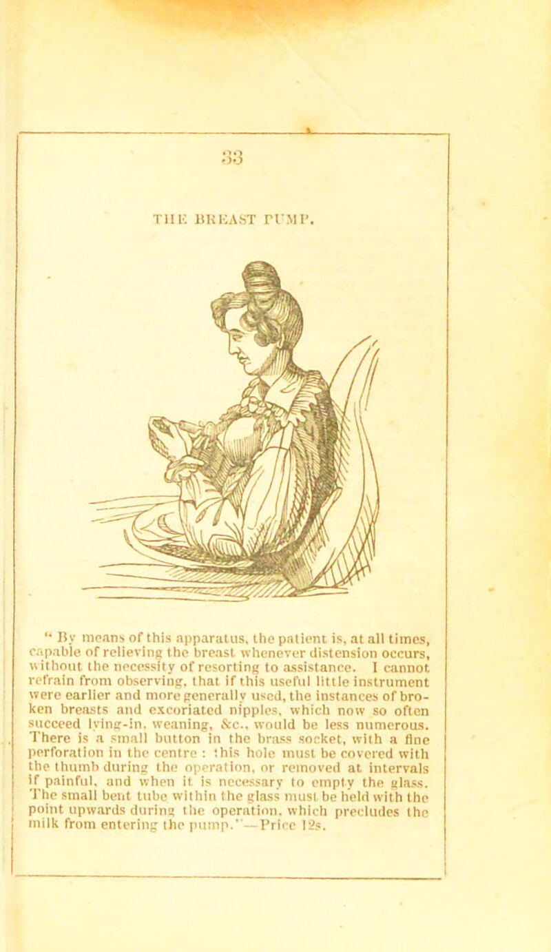 %. :5;3 TUK UKHAST n MI\ “ By moans of this apparatus, the patient is, at all times, capable of relieving the breast whenever distension occurs, \uthout the necessity of resorting to assistance. I cannot refrain from observing, that if this useful little instrument were earlier and more generally used, the instances of bro- ken breasts and excoriated nipples, which now so often succeed lying-in, weaning, &c., would be less numerous. There is a small button In the brass socket, with a fine perforation in the centre : this hole must be covered with the thumb during the operation, or removed at intervals if painful, and when it is necessary to empty the glass. The small bent tube within the glass must be held with the point upwards during the operation, which precludes the milk from entering the pump.”—Price I2s.