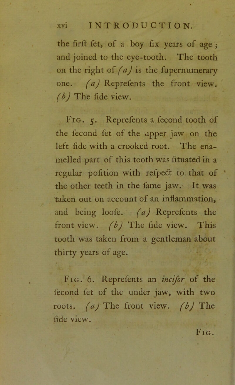 the firft fet, of a boy fix years of age ; and joined to the eye-tooth. The tooth on the right of (a) is the fupernumerary one. (a) Reprefents the front view. (b) The fide view. Fig. 5. Reprefents a fecond tooth of the fecond fet of the upper jaw on the left fide with a crooked root. The ena- melled part of this tooth was fituated in a regular pofition with refped: to that of ’ the other teeth in the fame jaw. It was taken out on account of an inflammation, and being loofe. (a) Reprefents the front view, (b) The fide view. This tooth was taken from a gentleman about thirty years of age. Fig. 6. Reprefents an incifor of the fecond fet of the under jaw, with two roots, (a) The front view, (b) The fide view. Fig.