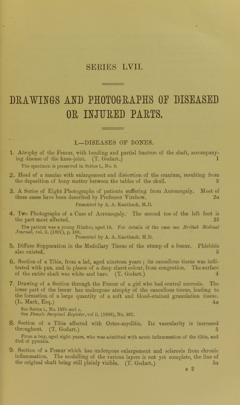 SERIES LVII. DRAWINGS AND PHOTOGRAPHS OP DISEASED OR INJURED PARTS. I.—DISEASES OF BONES. 1. Atrophy of the Femur, with bending and partial fracture of the shaft, accompany- ing disease of the knee-joint. (T. Godart.) 1 The specimen is preserved in Scries i., No. 8. 2. Head of a maniac with enlargement and distortion of the cranium, resulting from the deposition of bony matter between the tables of the skull. 2 3. A Series of Eight Photographs of patients suffering from Acromegaly. Most of these cases have been described by Professor Virchow. 2a Presented by A. A. Ivanthack, M.D. 4. Two Photographs of a Case of Acromegaly. The second too of the left foot is the part most affected. 2b The patient was a young Hindoo, aged 18. For details of the case see British Medical Journal, vol. ii. (1891), p. 188. Presented by A. A. Kanthack, M.D. 5. Diffuse Suppuration in the Medullary Tissuo of the stump of a femur. Phlebitis also existed. 3 6. Section of a Tibia, from a lad, aged nineteen years ; its cancellous tissuo was infil- trated with pus, and in places of a deep claret colour, from congestion. The surface of the entire shaft was white and bare. (T. Godart.) 4 7. Drawing of a Section through the Femur of a girl who had central necrosis. The lower part of the femur has undergone atrophy of the cancellous tissue, leading to the formation of a large quantity of a soft and blood-stained granulation tissue. (L. Mark, Esq.) 4a See Series i., No. 138b and c. See Female Surgical Register, vol ii. (1888), No. 367. 8. Section of a Tibia affected with Osteo-myclitis. Its vascularity is increased throughout. (T. Godart.) 5 From a boy, aged eight years, who was admitted with acute inflammation of the tibia, and died of pyaunia. 9. Section of a Femur which has undergone enlargement and sclerosis from chronic inflammation. The modelling of the various layers is not yet complete, tho lino of the original shaft being still plainly visible. (T. Godart.) 5a b 2