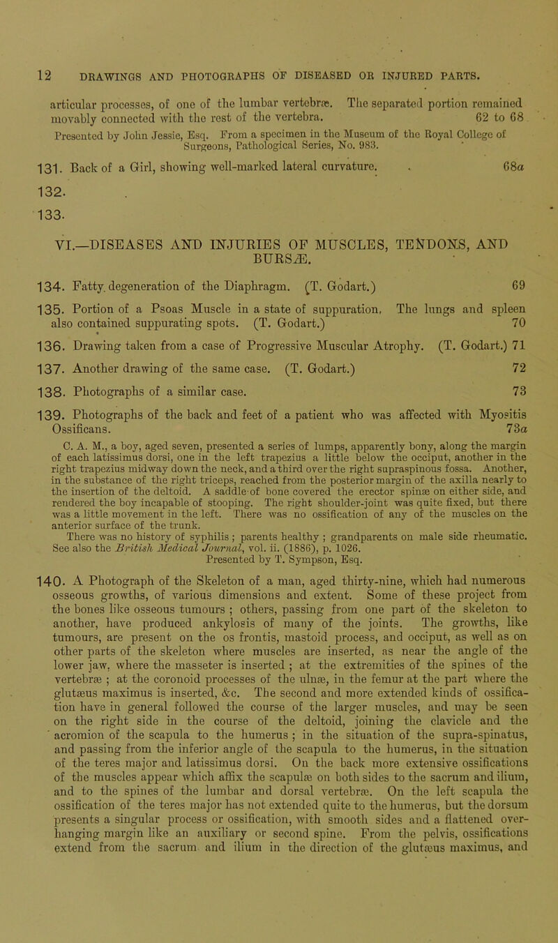 articular processes, of one of the lumbar vertebra;. The separated portion remained movably connected with the rest of the vertebra. 62 to 68 Presented by John Jessie, Esq. From a specimen in the Museum of the Royal College of Surgeons, Pathological Series, No. 983. 131. Back of a Girl, showing well-marked lateral curvature. . 68a 132. 133. VI.—DISEASES AND INJURIES OF MUSCLES, TENDONS, AND BURSiE. 134. Fatty, degeneration of the Diaphragm. (T. Godart.) 69 135. Portion of a Psoas Muscle in a state of suppuration, The lungs and spleen also contained suppurating spots. (T. Godart.) 70 « 136. Drawing taken from a case of Progressive Muscular Atrophy. (T. Godart.) 71 137. Another drawing of the same case. (T. Godart.) 72 138. Photographs of a similar case. 73 139. Photographs of the back and feet of a patient who was affected with Myositis Ossificans. 73a C. A. M., a boy, aged seven, presented a series of lumps, apparently bony, along the margin of each latissimus dorsi, one in the left trapezius a little below the occiput, another in the right trapezius midway down the neck, and a third over the right supraspinous fossa. Another, in the substance of the right triceps, reached from the posterior margin of the axilla nearly to the insertion of the deltoid. A saddle of bone covered the erector spinae on either side, and rendered the boy incapable of stooping. The right shoulder-joint was quite fixed, but there was a little movement in the left. There was no ossification of any of the muscles on the anterior surface of the trunk. There was no history of syphilis ; parents healthy ; grandparents on male side rheumatic. See also the British Medical Journal, vol. ii. (1886), p. 1026. Presented by T. Sympson, Esq. 140- A Photograph of the Skeleton of a man, aged thirty-nine, which had numerous osseous growths, of various dimensions and extent. Some of these project from the bones like osseous tumours ; others, passing from one part of the skeleton to another, have produced ankylosis of many of the joints. The growths, like tumours, are present on the os frontis, mastoid process, and occiput, as well as on other parts of the skeleton where muscles are inserted, as near the angle of the lower jaw. where the masseter is inserted ; at the extremities of the spines of the vertebra; ; at the coronoid processes of the ulna;, in the femur at the part where the glutajus maximus is inserted, &c. The second and more extended kinds of ossifica- tion have in general followed the course of the larger muscles, and may be seen on the right side in the course of the deltoid, joining the clavicle and the ' acromion of the scapula to the humerus ; in the situation of the supra-spinatus, and passing from the inferior angle of the scapula to the humerus, in the situation of the teres major and latissimus dorsi. On the back more extensive ossifications of the muscles appear which affix the scapula; on both sides to the sacrum and ilium, and to the spines of the lumbar and dorsal vertebra;. On the left scapula the ossification of the teres major has not extended quite to the humerus, but the dorsum presents a singular process or ossification, with smooth sides and a flattened over- hanging margin like an auxiliary or second spine. From the pelvis, ossifications extend from the sacrum and ilium in the direction of the gluta;us maximus, and